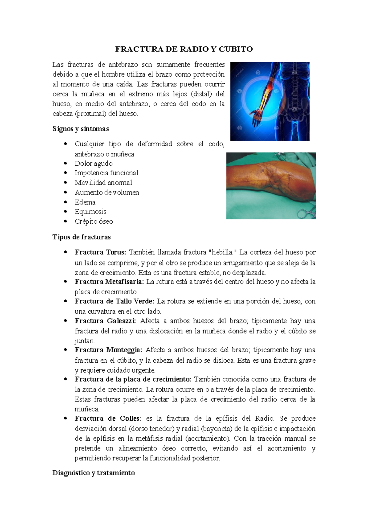 fractura-de-radio-y-cubito-fractura-de-radio-y-cubito-las-fracturas