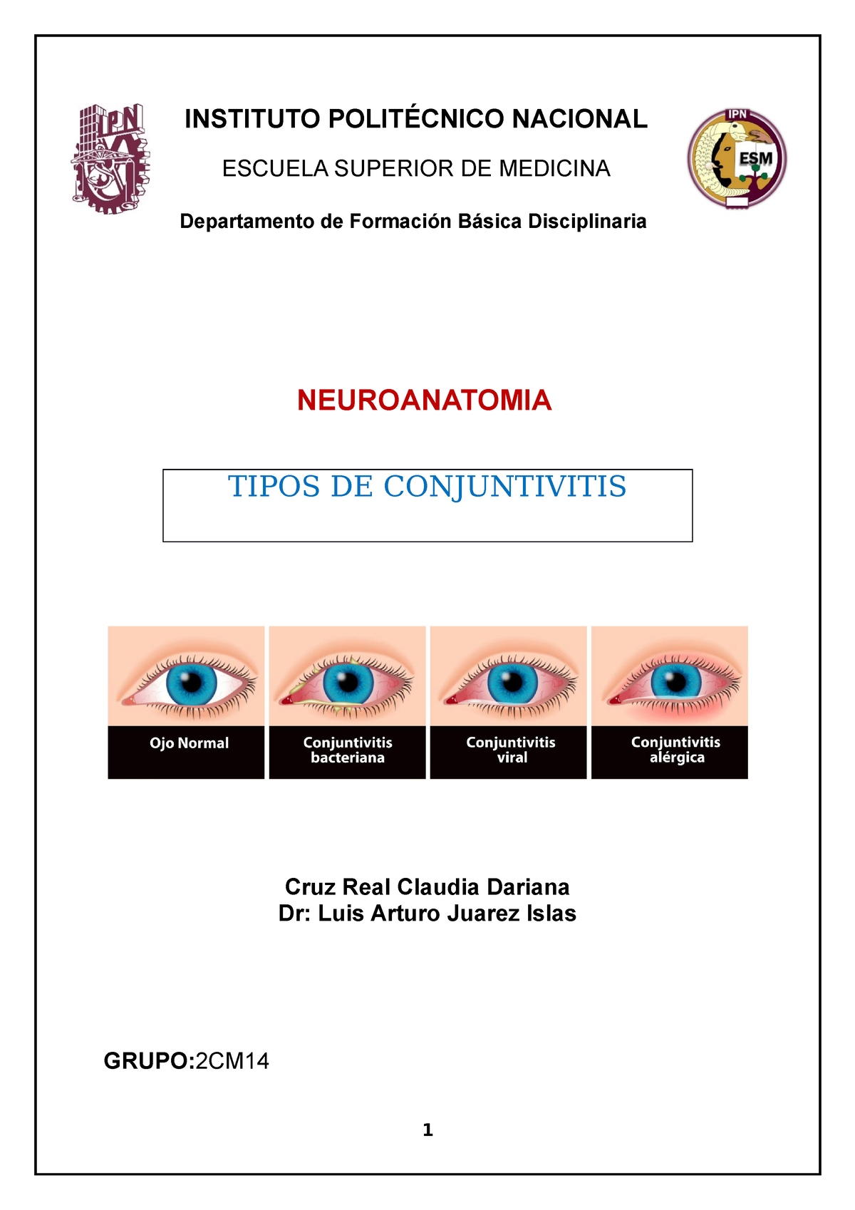 Conjuntivitis - Según el tipo de secreción ocular producida se puede  orientar el diagnóstico y, de - Studocu