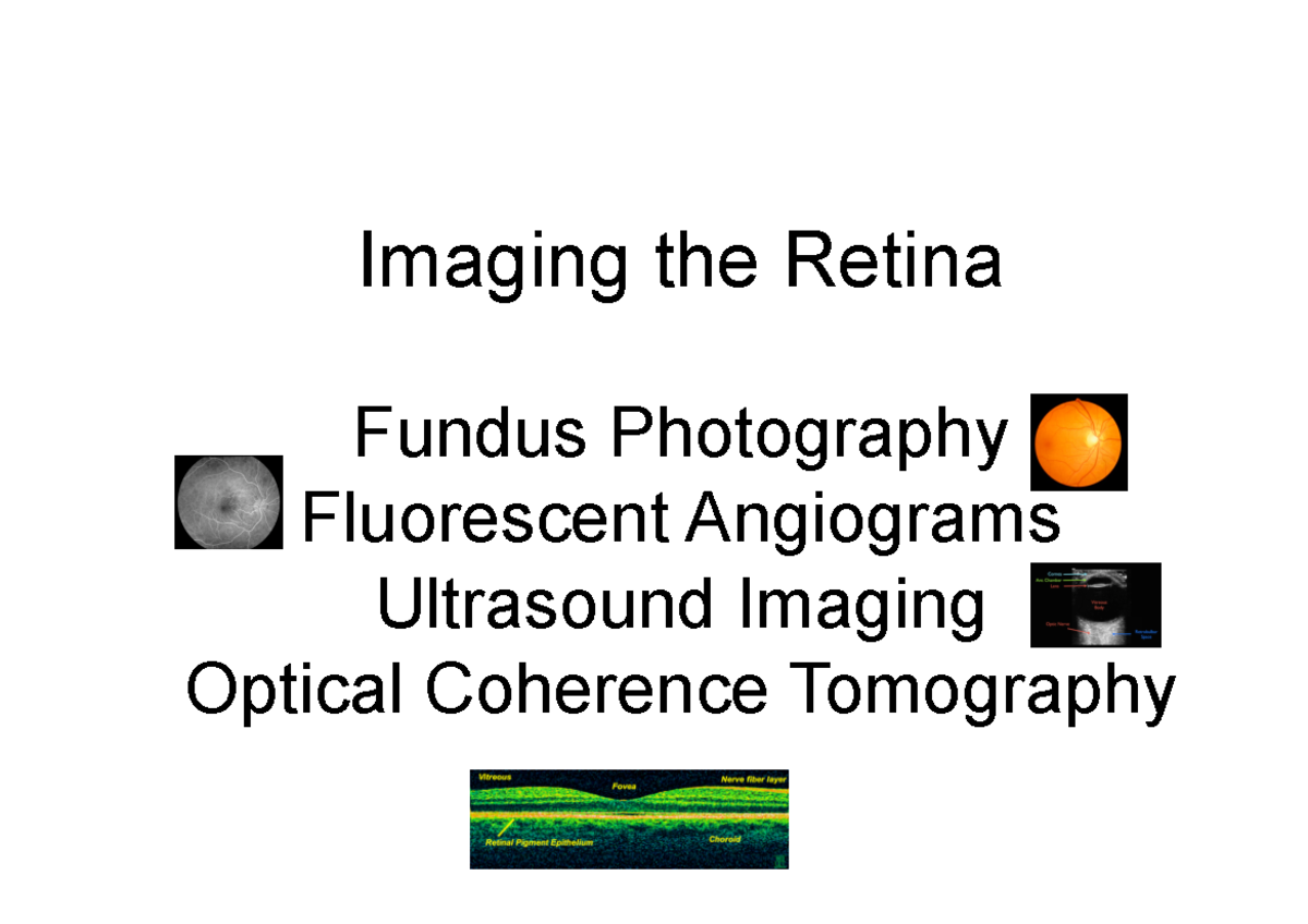 Ophthalmic Anatomy and Physiology Retinal Imaging Lecture Notes Imaging the Retina Fundus