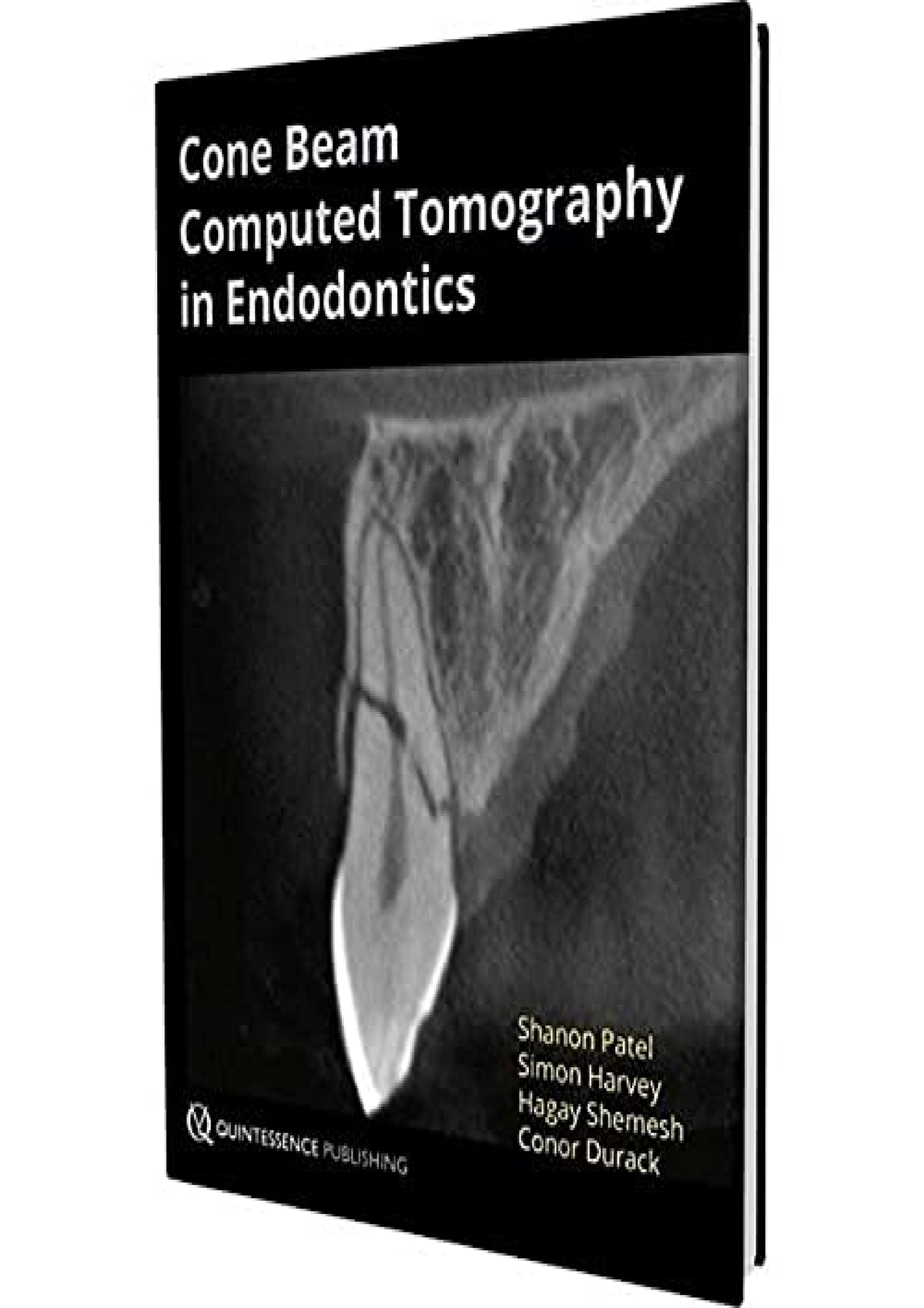 [PDF READ ONLINE] Cone Beam Computed Tomography In Endodontics - Cone ...