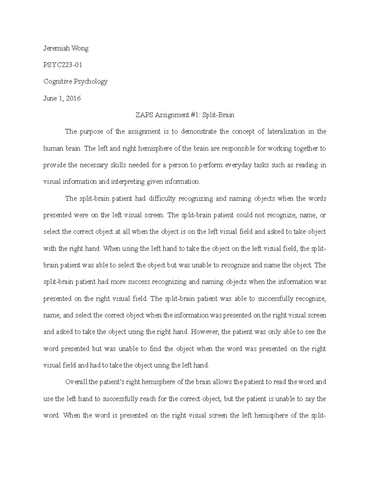 Seminar assignments Splitbrain zaps Jeremiah Wong Cognitive