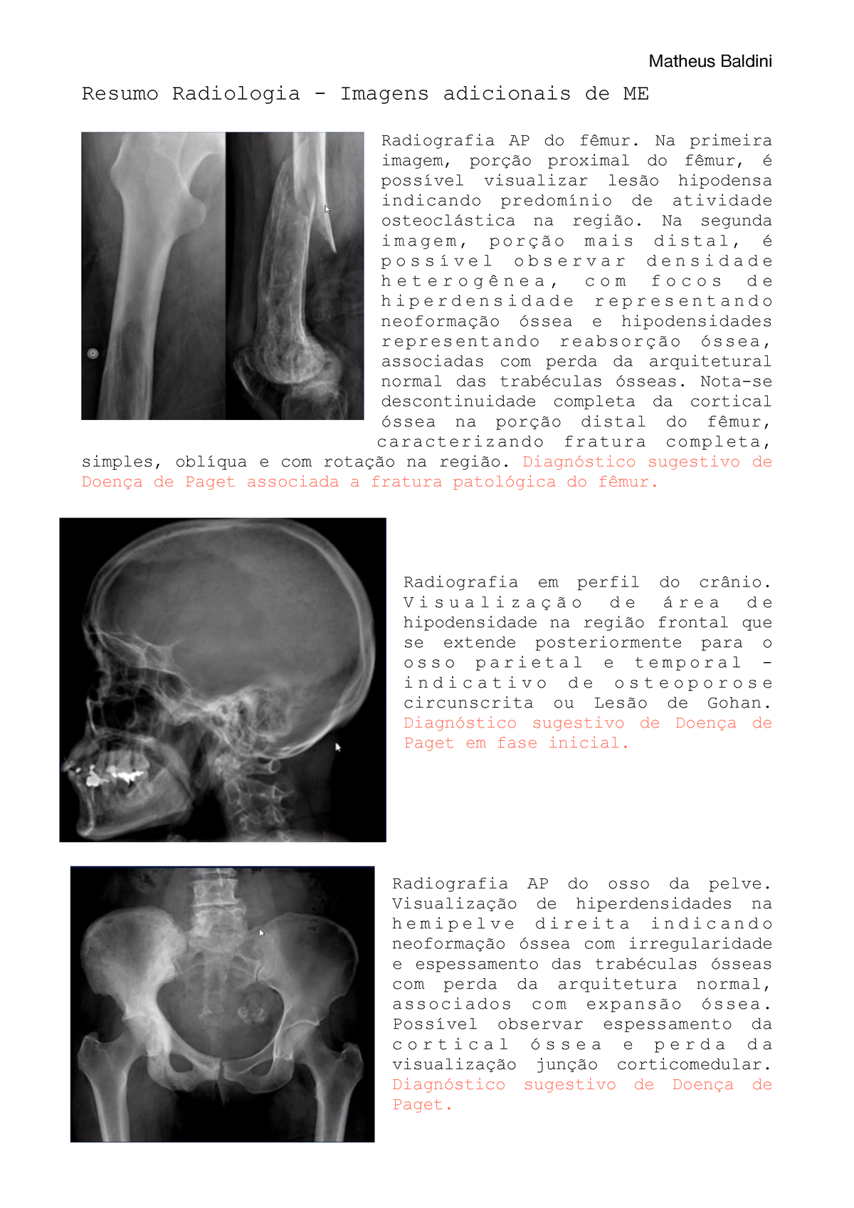 Estudo Radiográfico do Crânio  Resumos Diagnóstico por Imagem