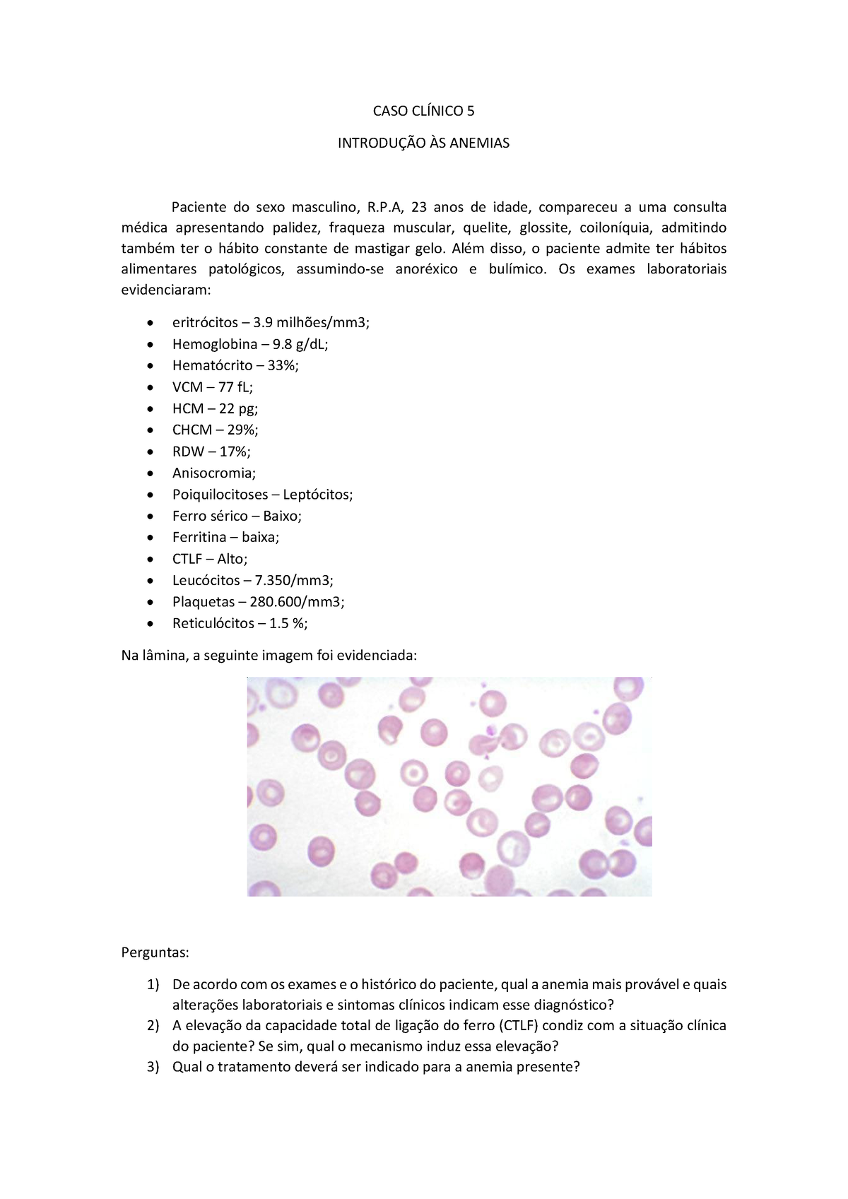 Caso Clínico 5 Hematologia Clínica Caso Fictício Caso ClÍnico 5 IntroduÇÃo Às Anemias 