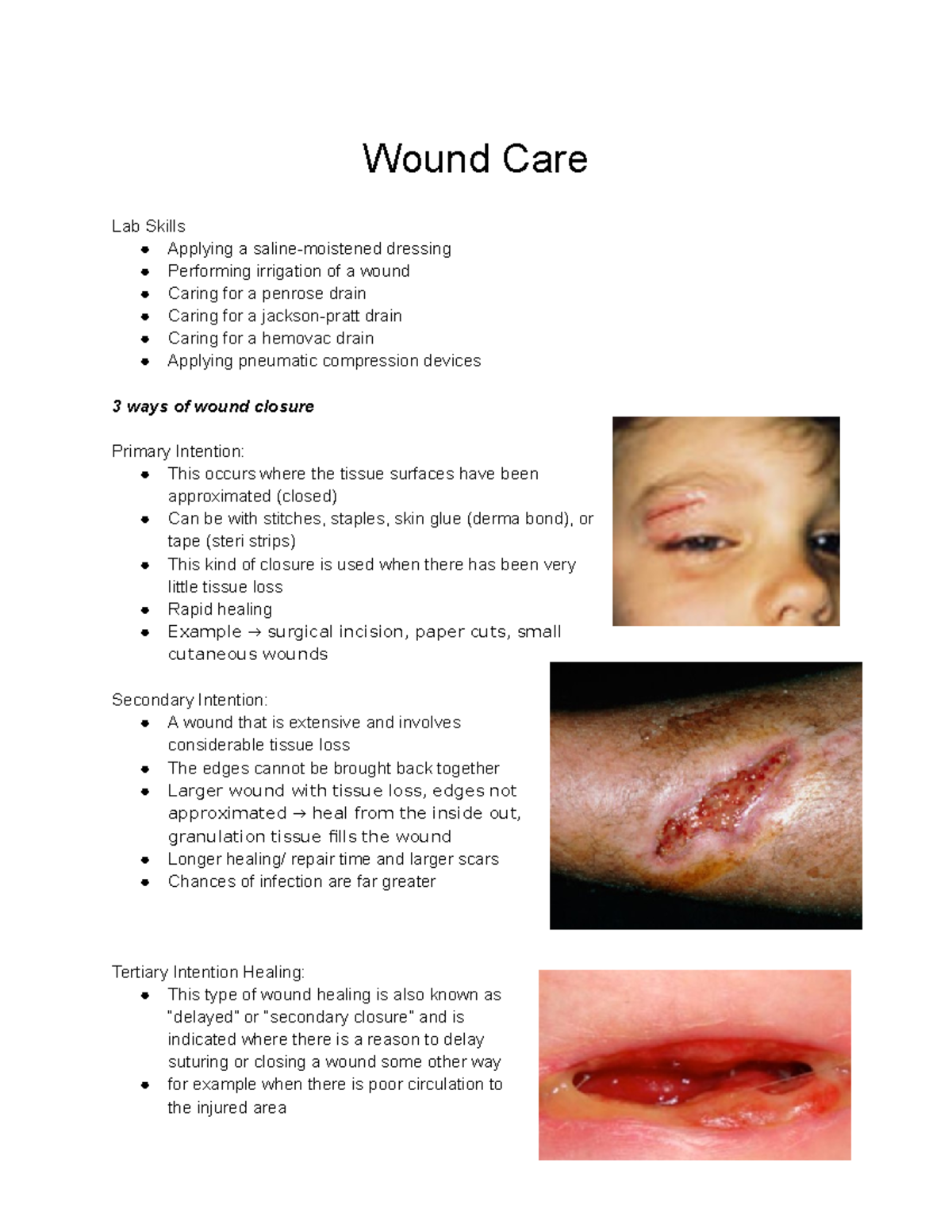 module-5-wound-care-wound-care-lab-skills-applying-a-saline