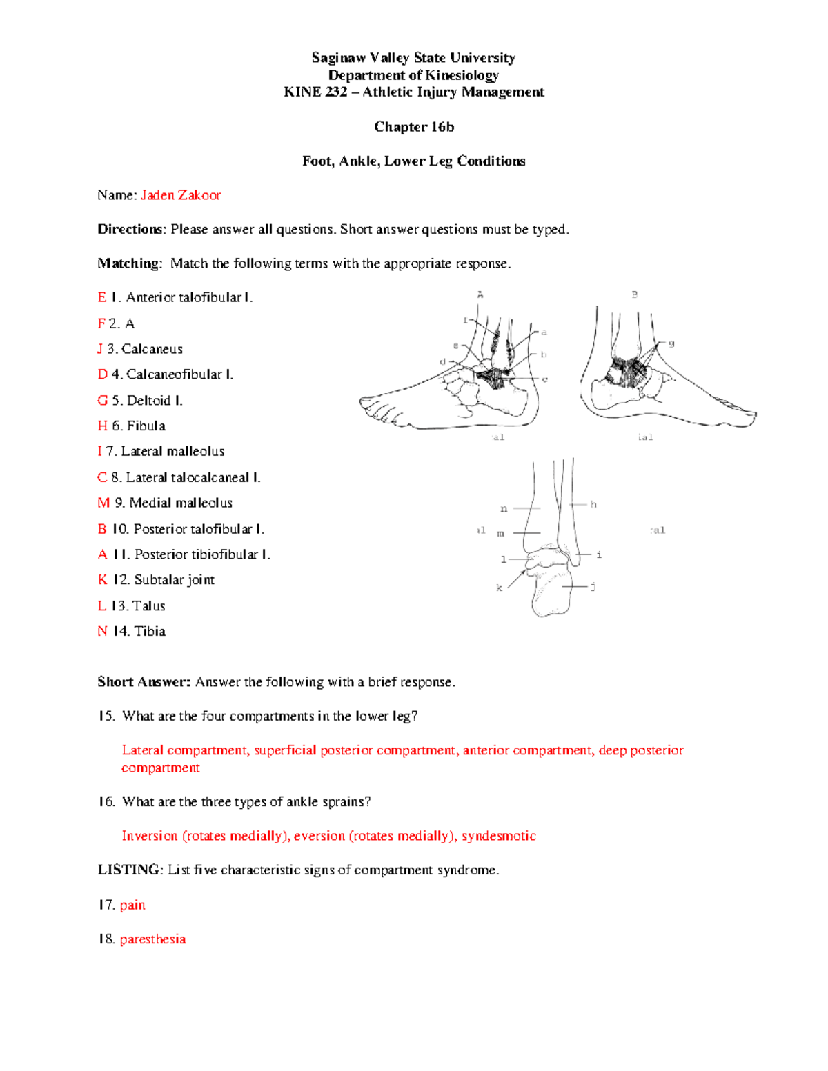 Chapter 16b - Ankle Conditions - Saginaw Valley State University ...