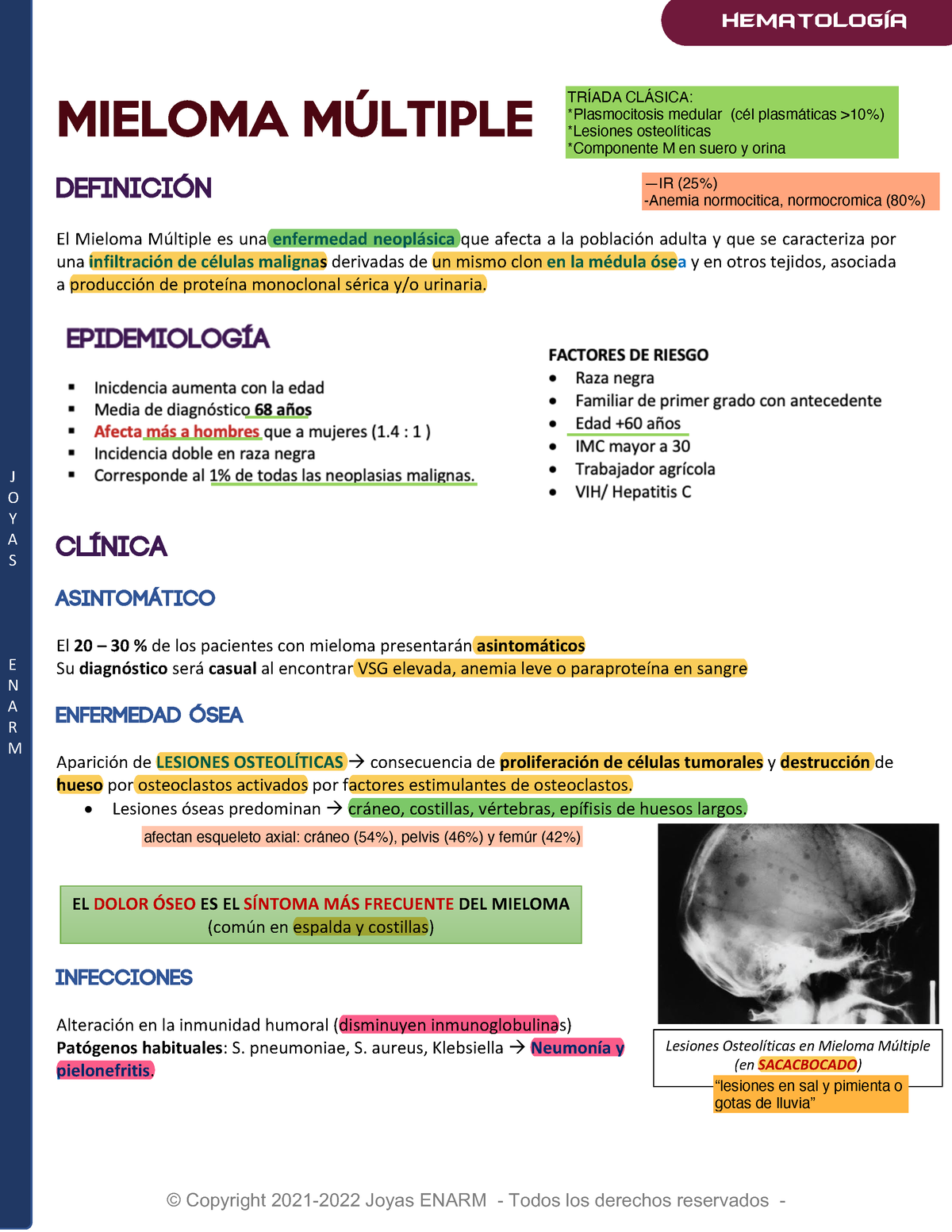 Mieloma Múltiple J O Y A S E N A R M MIELOMA MÚLTIPLE DEFINICIÓN El Mieloma Múltiple es