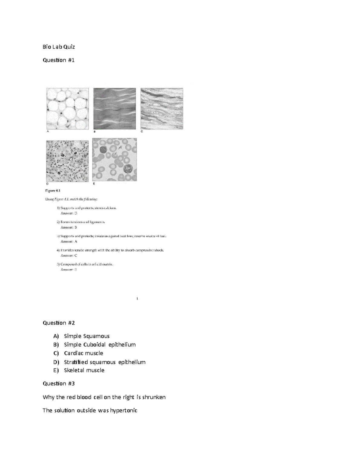 Bio Lab Quiz bio quiz Bio Lab Quiz Question Question 2 A) Simple Squamous B) Simple