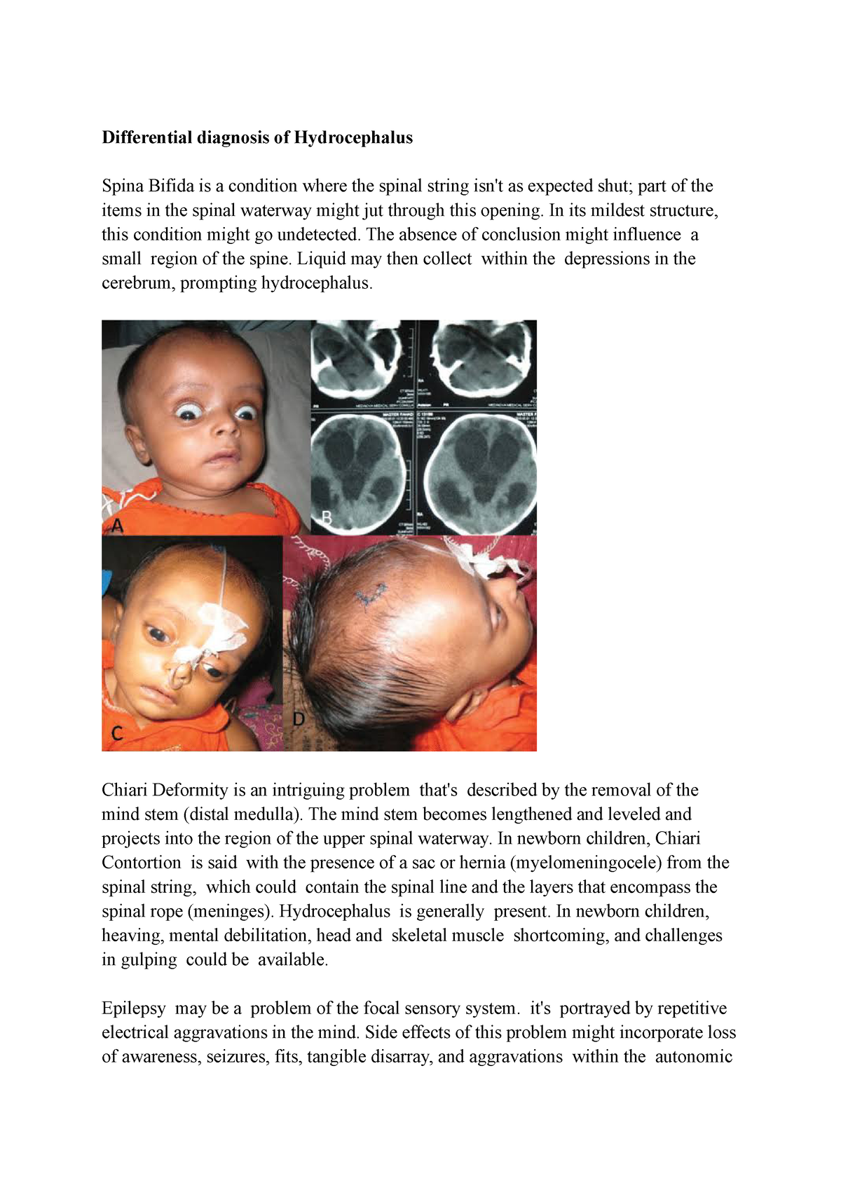 Diagnosis Of Hydrocephalus Differential Diagnosis Of Hydrocephalus Spina Bifida Is A Condition 4848