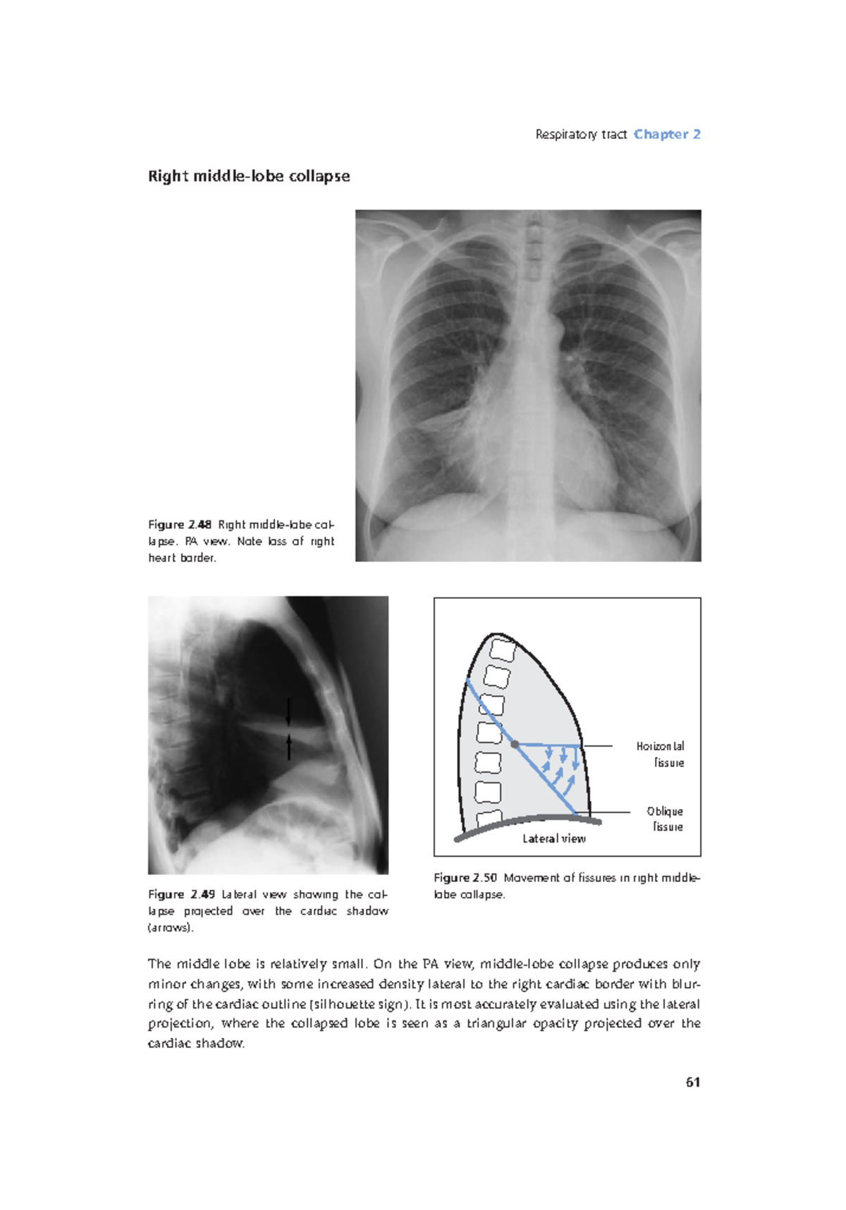 Radiology Lecture Notes pdf (21) Respiratory tract Chapter 2 61