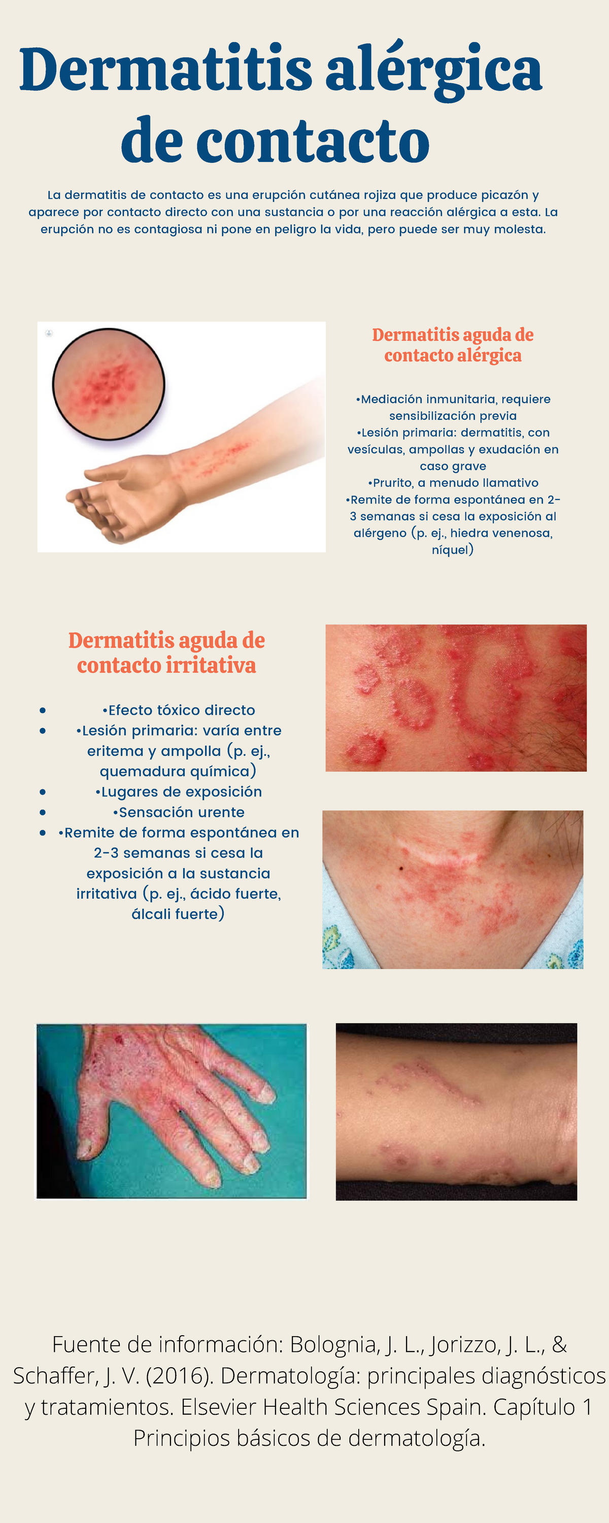 mecanismo de la dermatitis alérgica de contacto