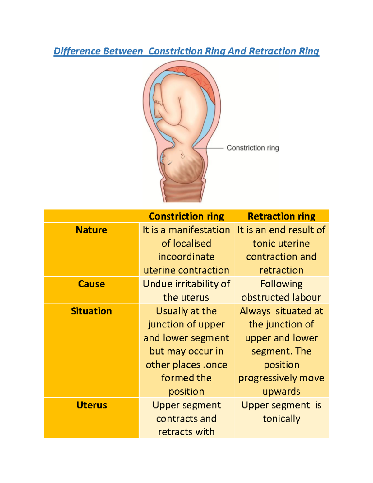 difference-between-constriction-ring-and-retraction-ring-difference