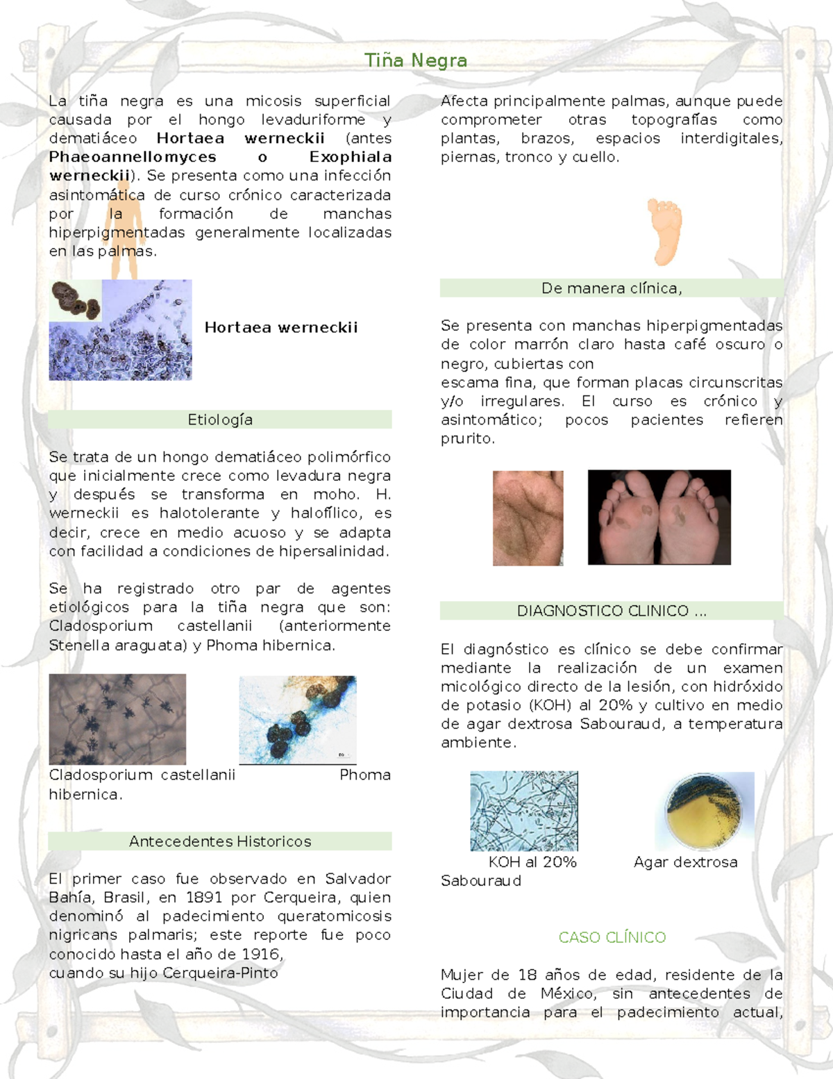 Parcial 1 - Agentes Biológicos - Tiña Negra La tiña negra es una