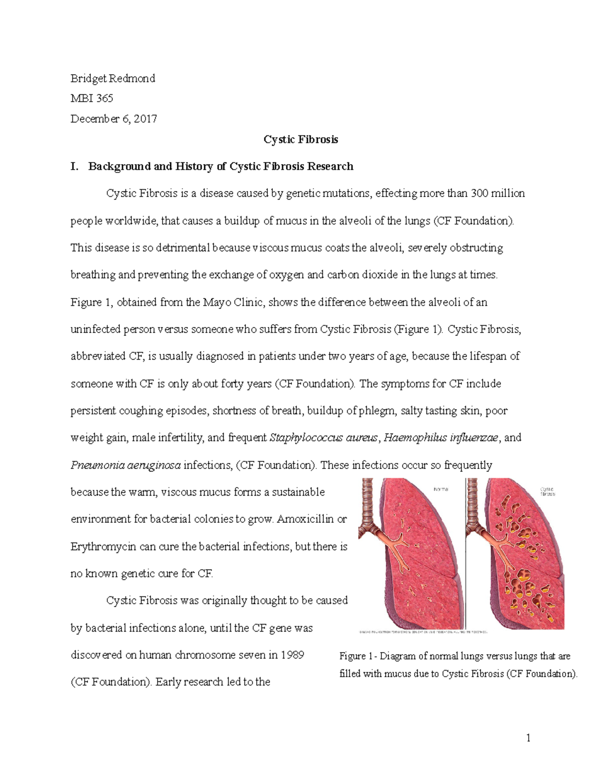 cystic fibrosis research paper example