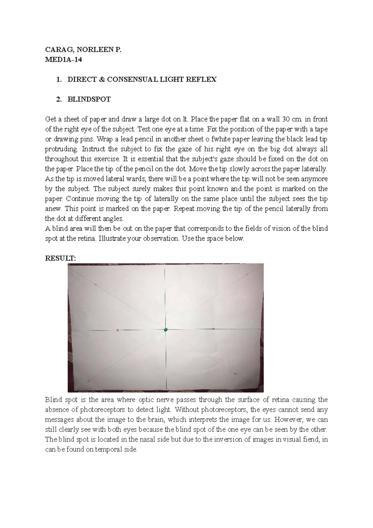 Vision LAB CARAG, NORLEEN P. MED1A 1. DIRECT & CONSENSUAL LIGHT