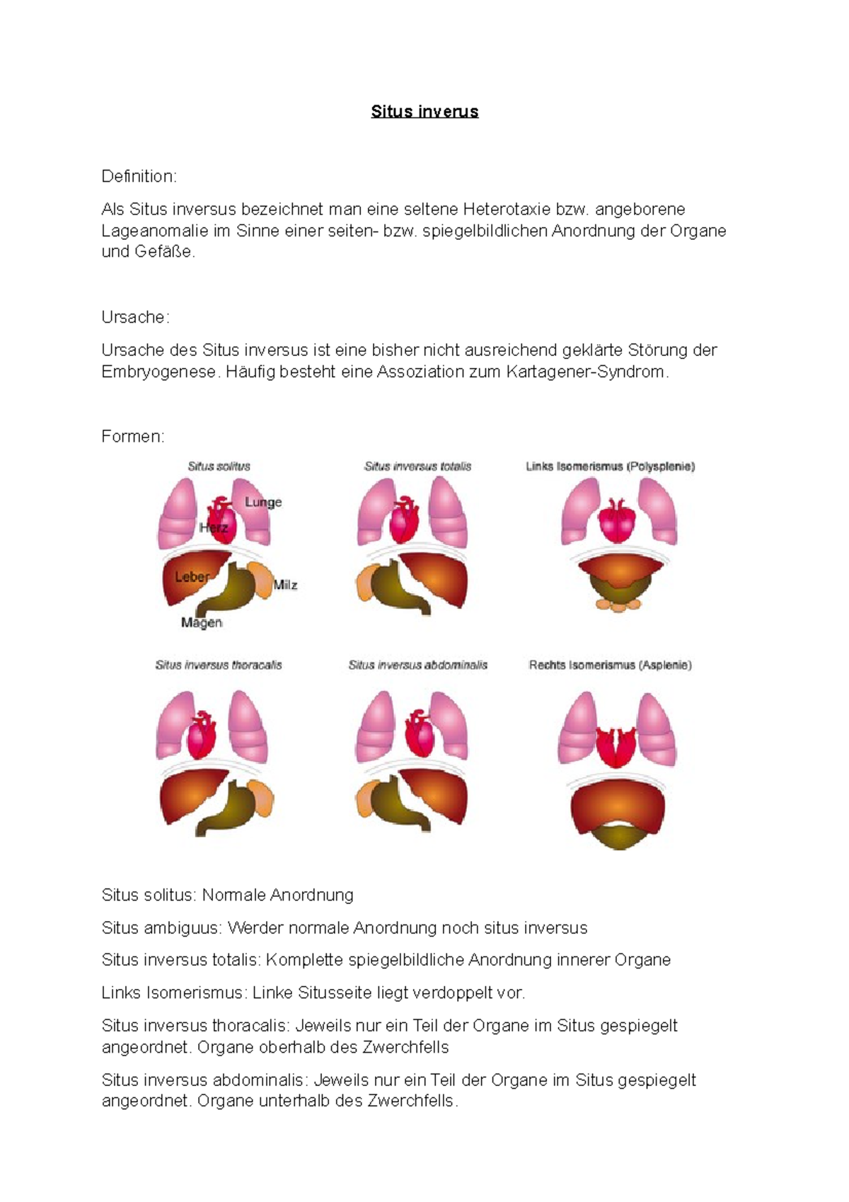 Situs inversus - Medecine - Situs inverus Definition: Als Situs ...