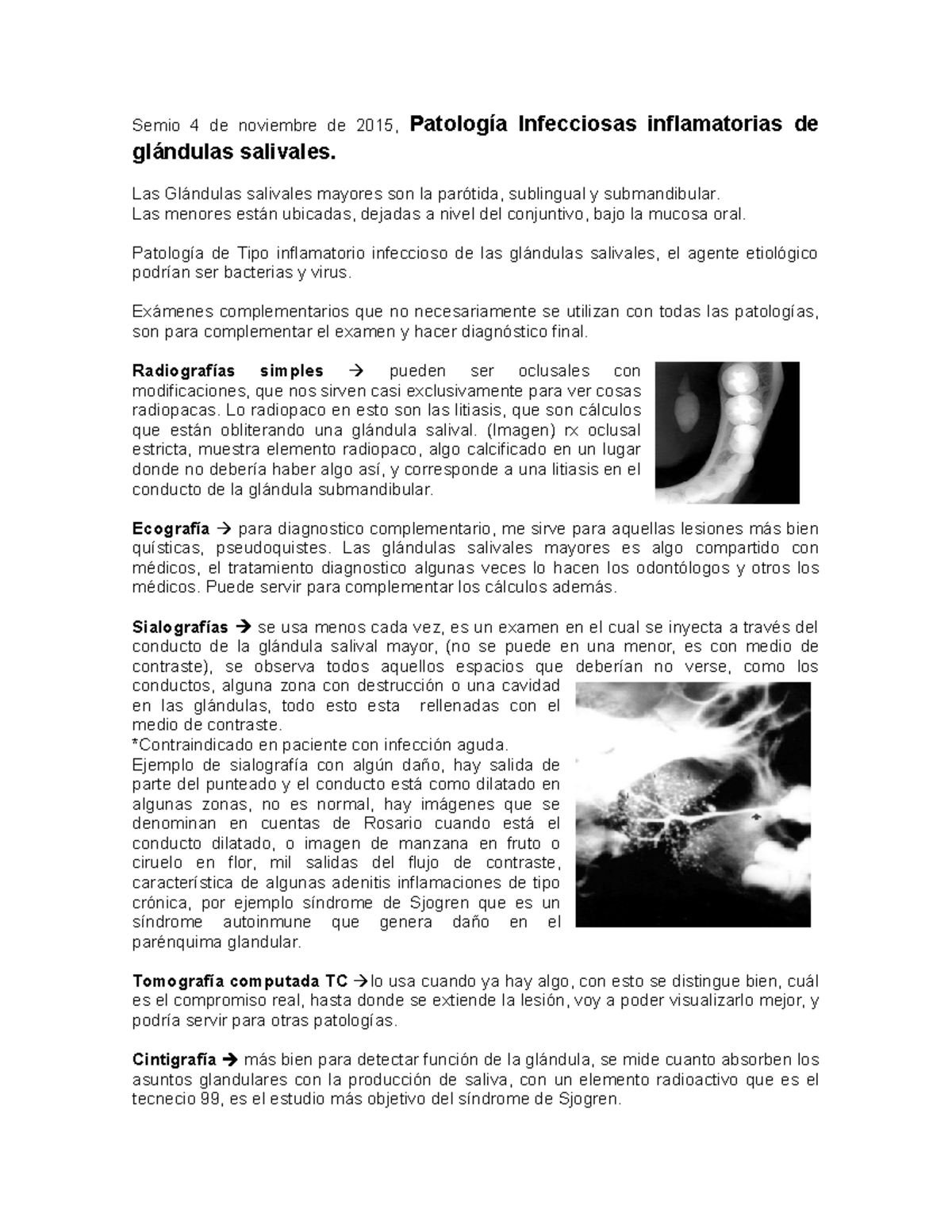 Patología Infecciosas Inflamatorias De Glándulas Salivales - Las ...