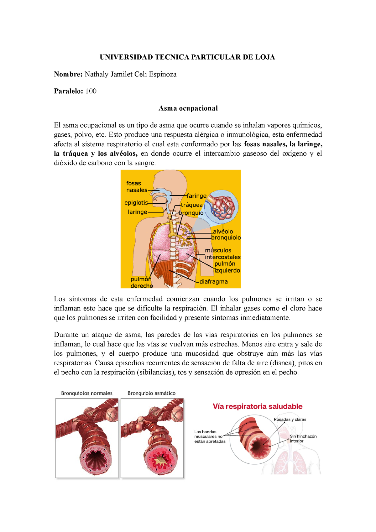 Asma Ocupacional Anatomia Universidad Tecnica Particular De Loja Nombre Nathaly Jamilet 5992