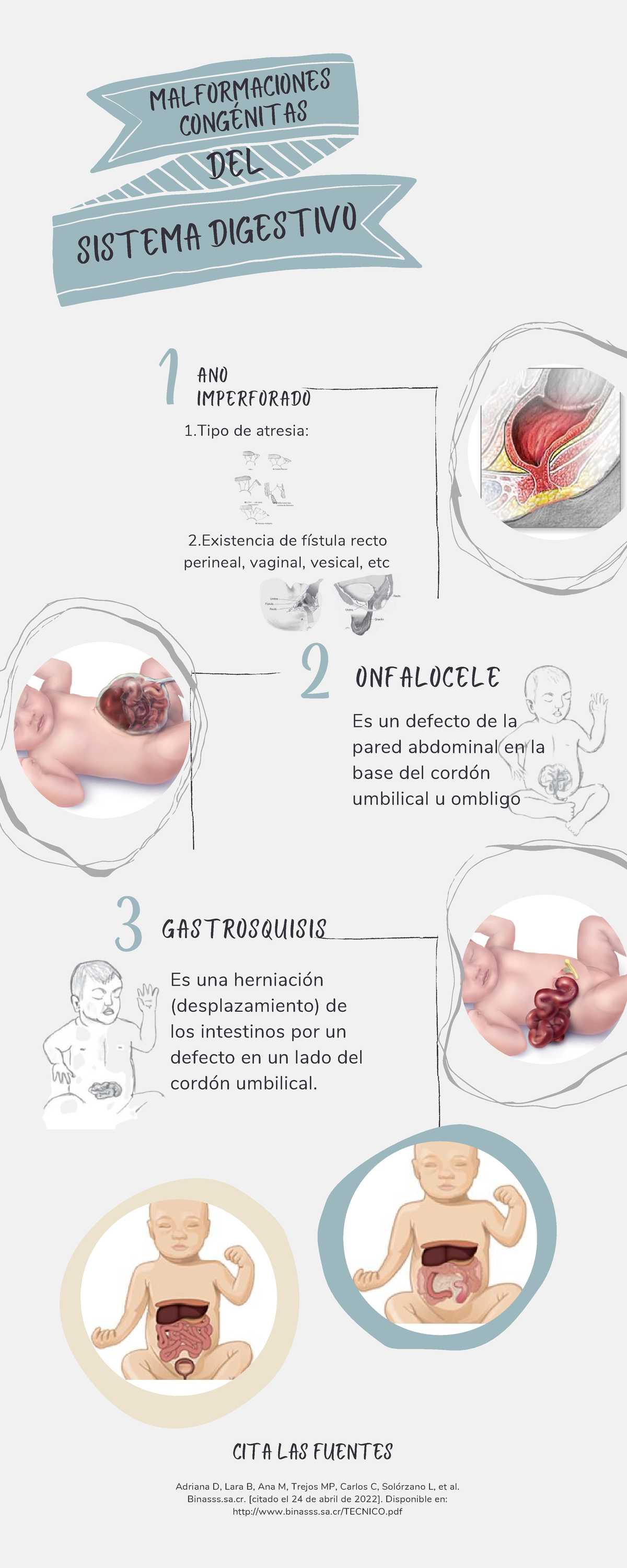 Malformaciones Congénitas Del Sistema Digestivo 2 1 De Atresia 2 De Fístula Recto Perineal 1574