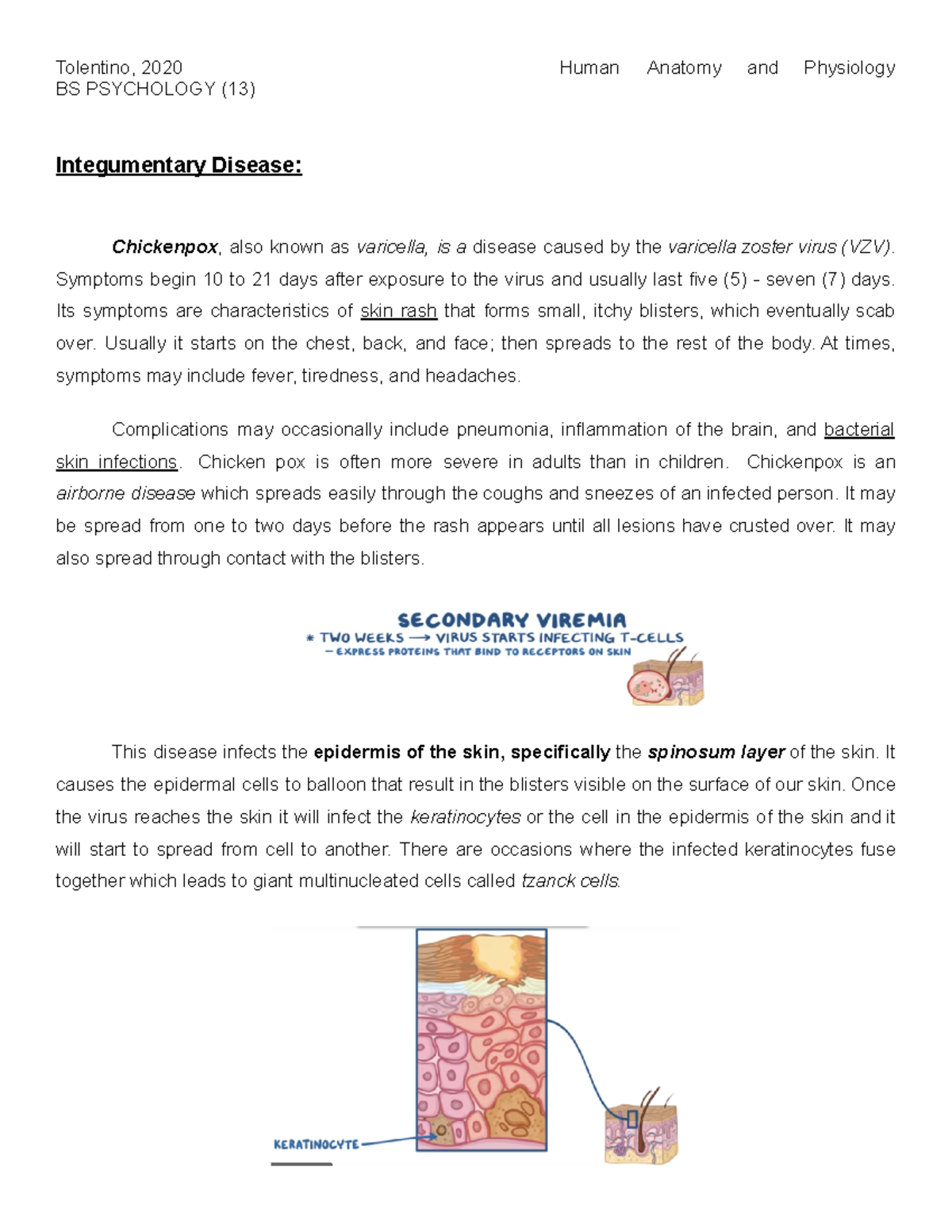 Integumentary Disease Chicken Pox (Human Anatomy and Physiology).docx ...