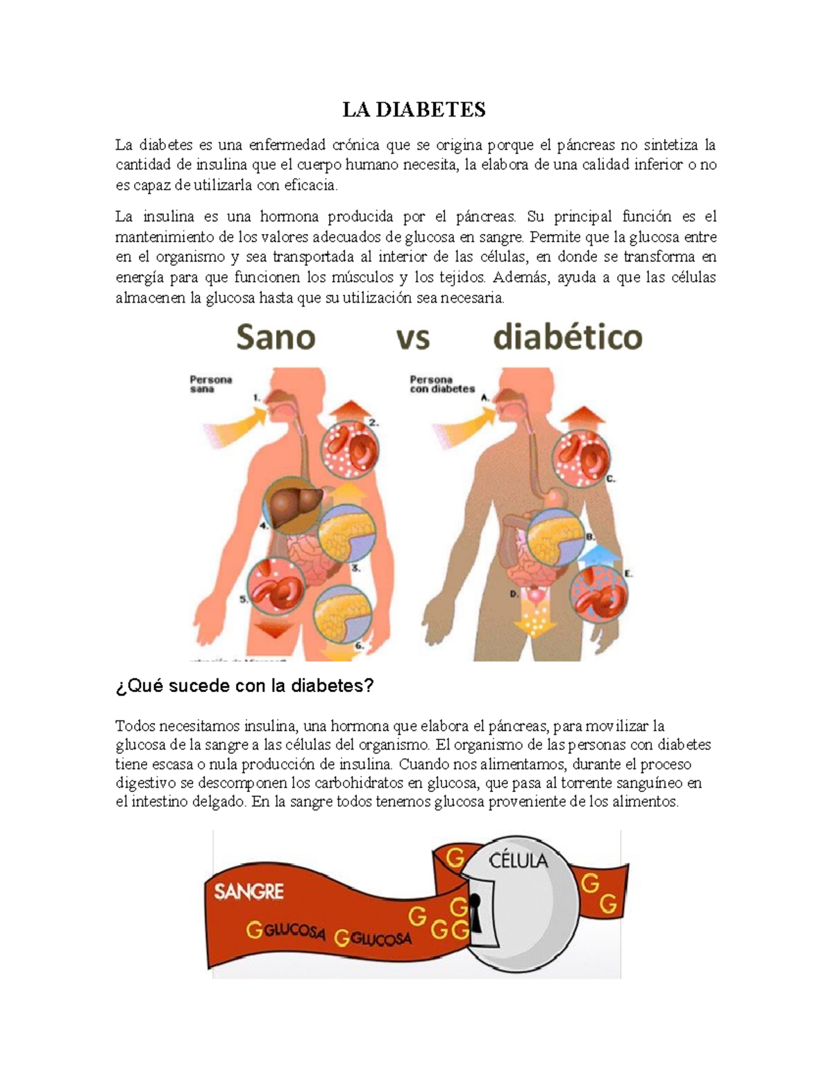 páncreas afectado por síntomas de diabetes