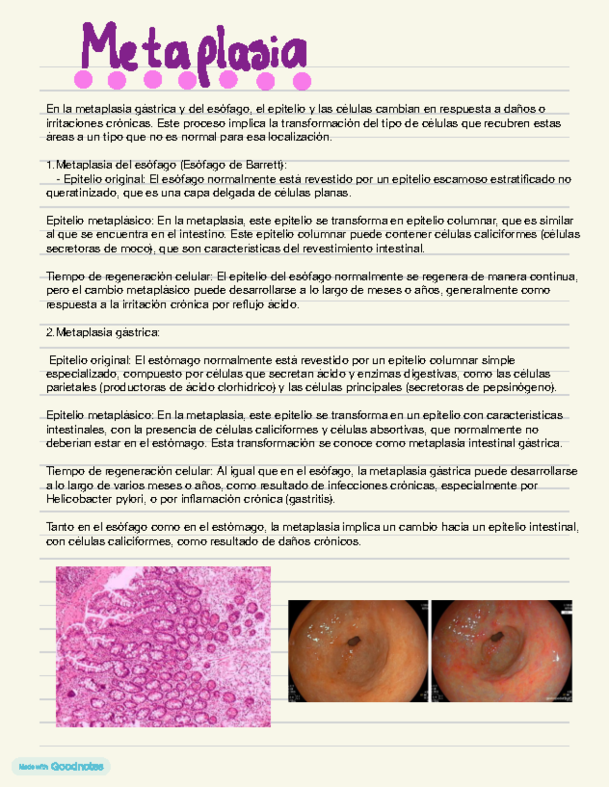 Metaplasia Y Colonoscopia - En la metaplasia gástrica y del esófago, el ...