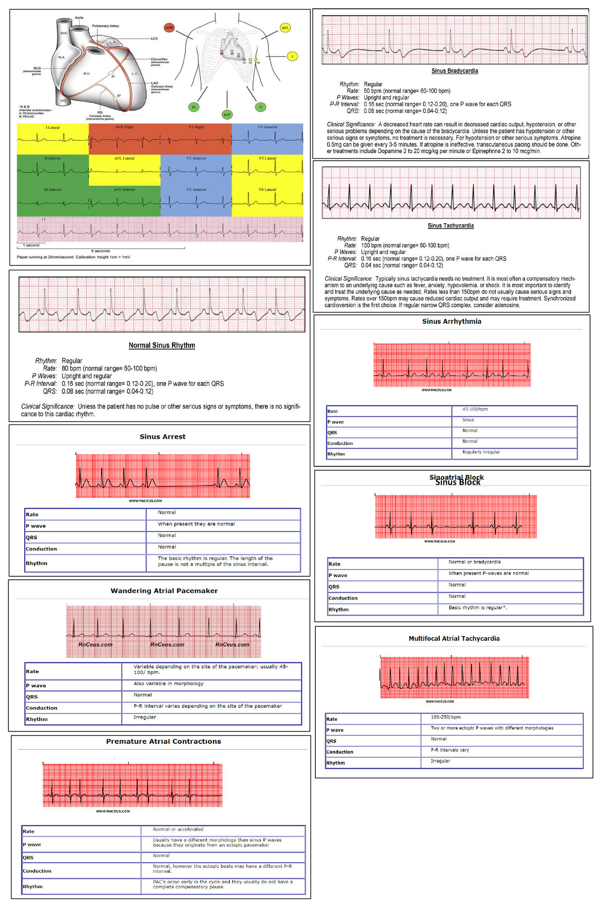 Ecg2 - 123456789 - fundamentals of nursing - Sinus Block - Studocu