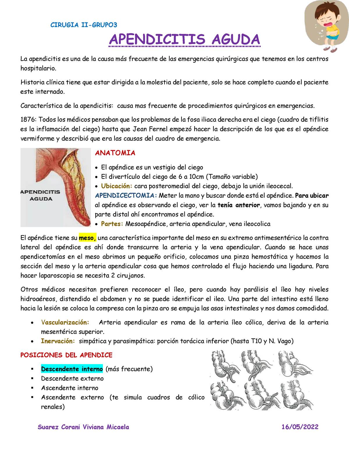 Apendicitis Aguda - APENDICITIS AGUDA La Apendicitis Es Una De La Causa ...