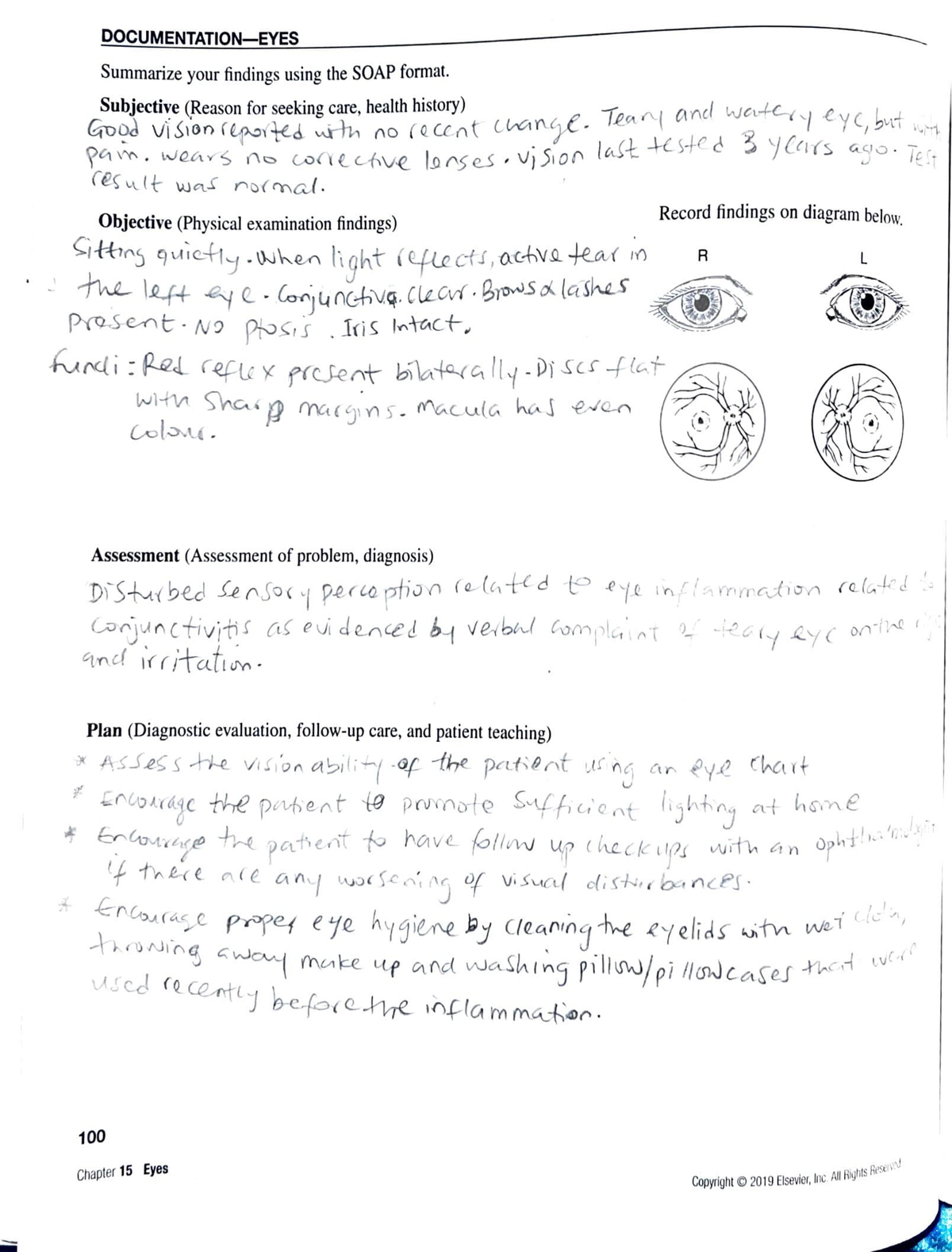 SOAP Eyes Nursing Diagnosis and SOAP note iiiii QDQOQCUMM§ENlA;I