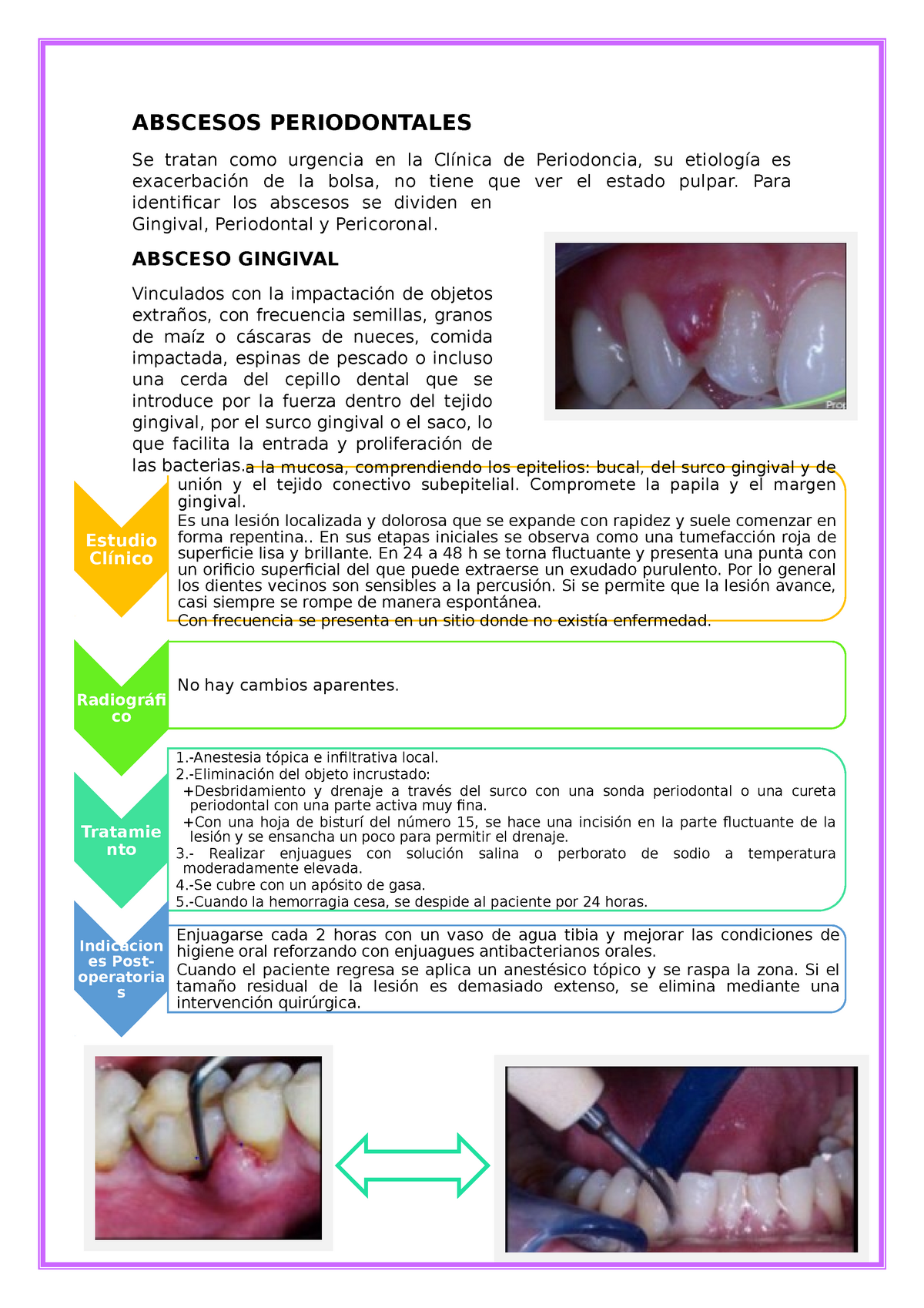 Abscesos Periodontales - Estudio Clínico Afectan A La Mucosa ...