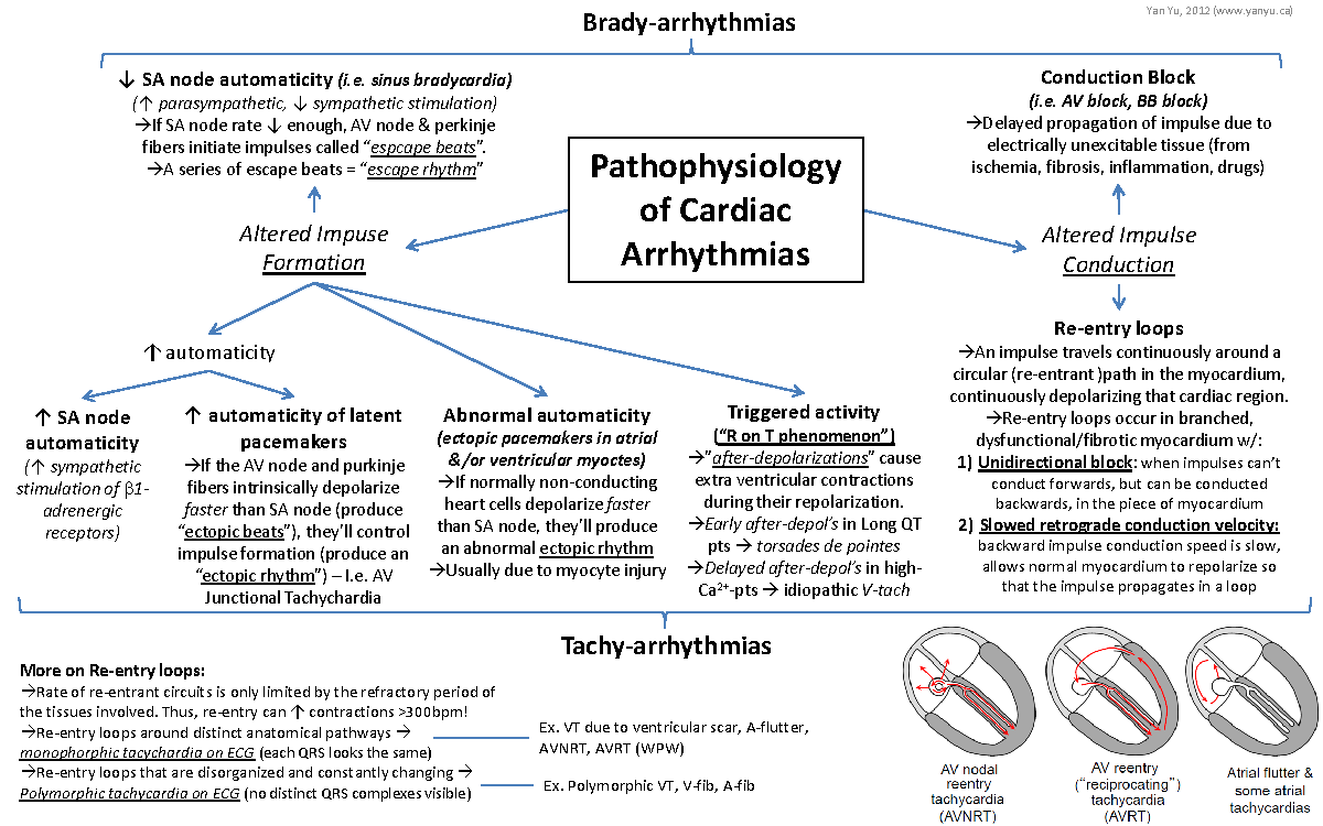 Cardiac Arrhythmias Pathophysiology - ↑ SA node automaticity (↑ ...