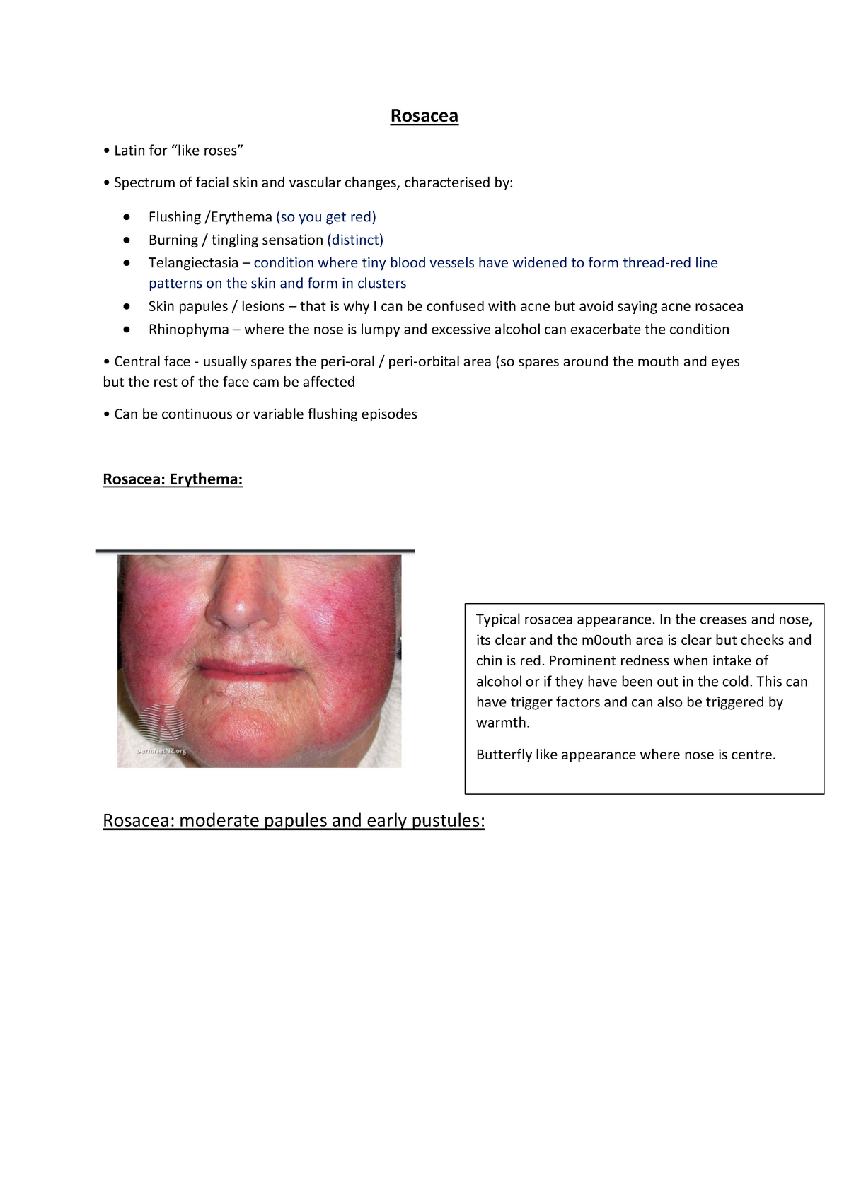 Rosacea - Rosacea Latin for “like roses” Spectrum of facial skin and ...