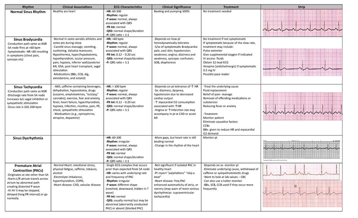 Studocu Dysrhythmia Chart With Treatment Normal Sinus Rhythm Healthy