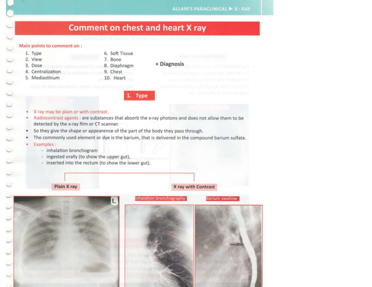 Chest x rays - Medicine and surgery - Studocu