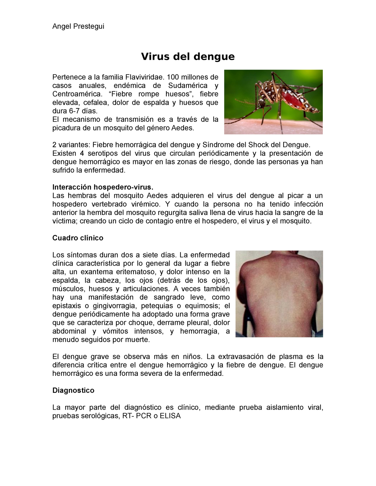 Virus del dengue - Angel Prestegui Virus del dengue Pertenece a la familia  Flaviviridae. 100 - Studocu