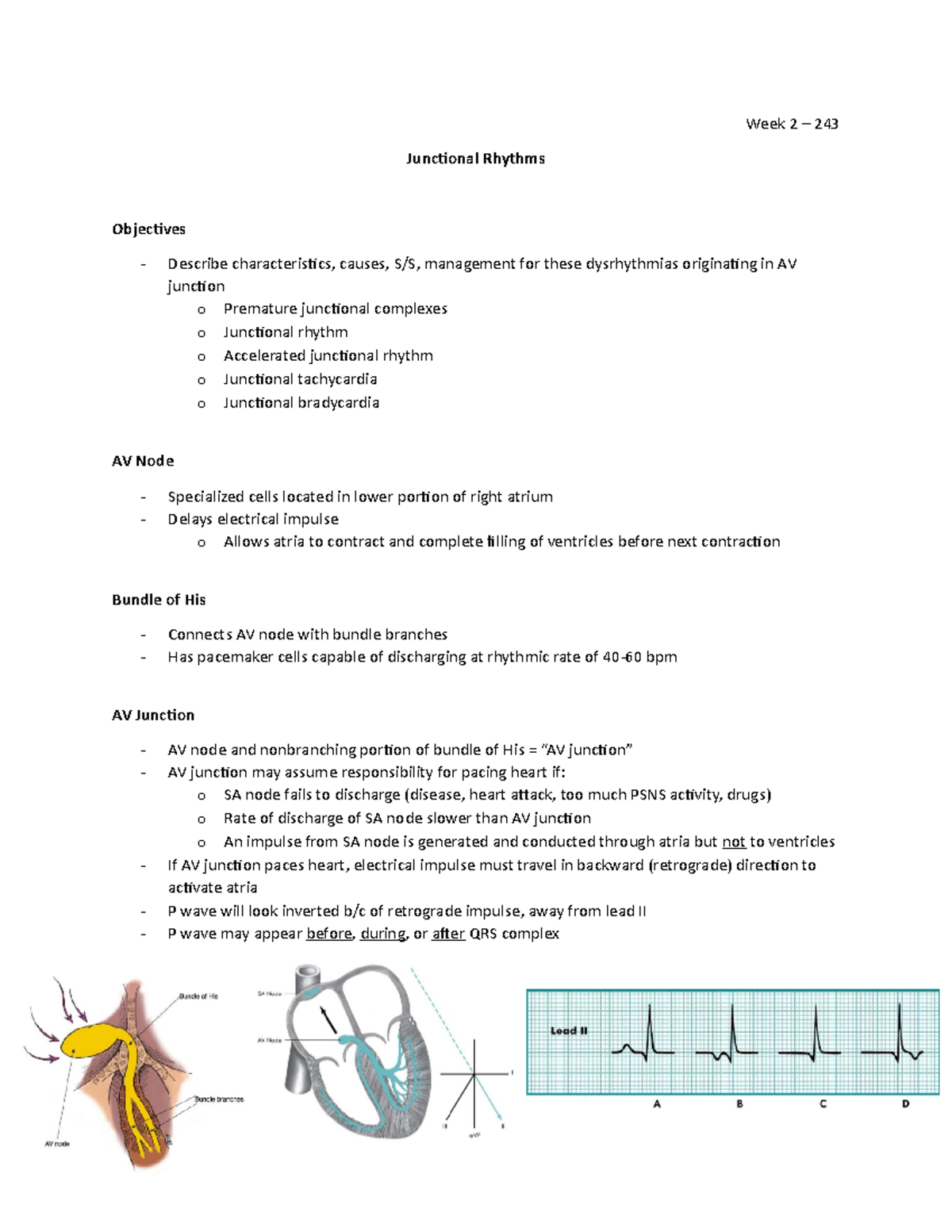 Week 2 Junctional Rhythms Week 2 243 Junctional Rhythms Objectives