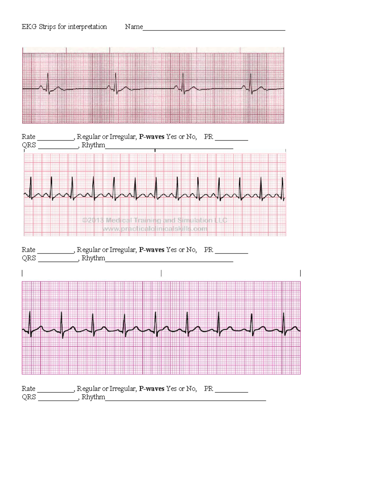 Ekg To Interperate 2021 Student - Ekg Strips For Interpretation - Studocu