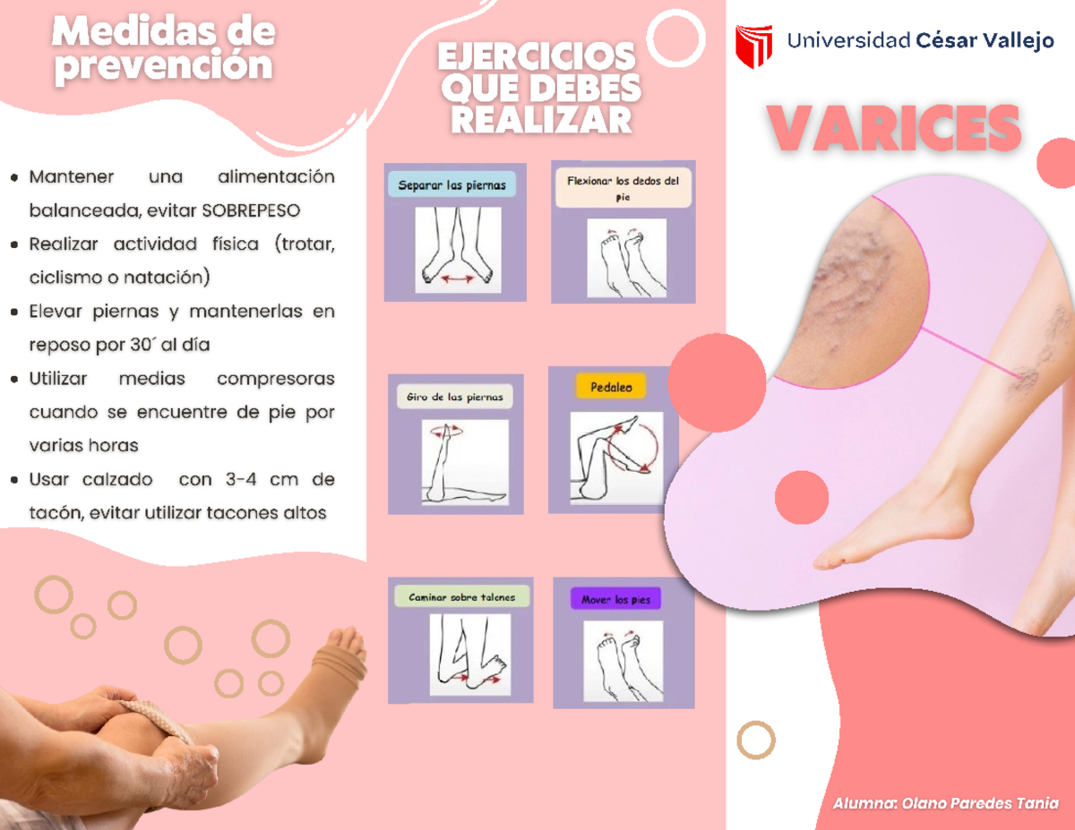Infografia de varices - Medidas de Universidad César Vallejo prevención ...