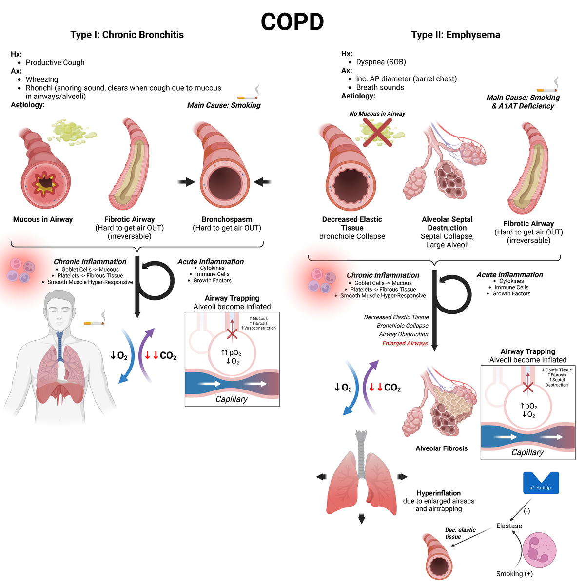 COPD - Biorender - COPD Summary Diagram - COPD Type I: Chronic ...