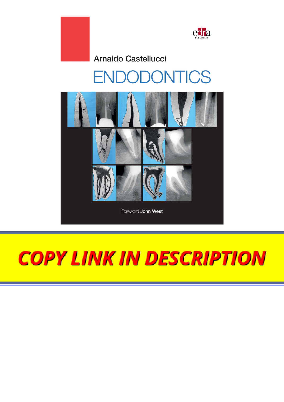 Download Pdf Endodontics 2 Volume Set For Android - Download PDF ...