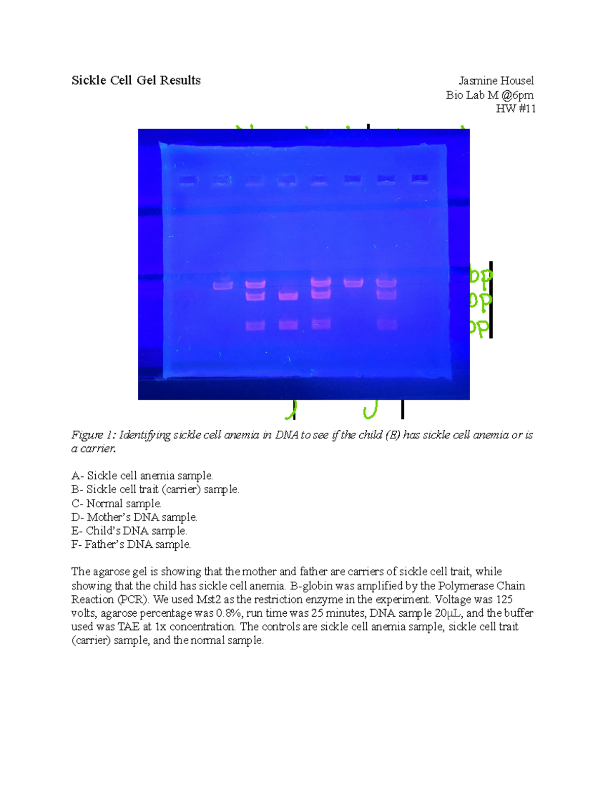 Bio HW #11 - Sickle Cell Gel Results Jasmine Housel Bio Lab M @6pm HW ...