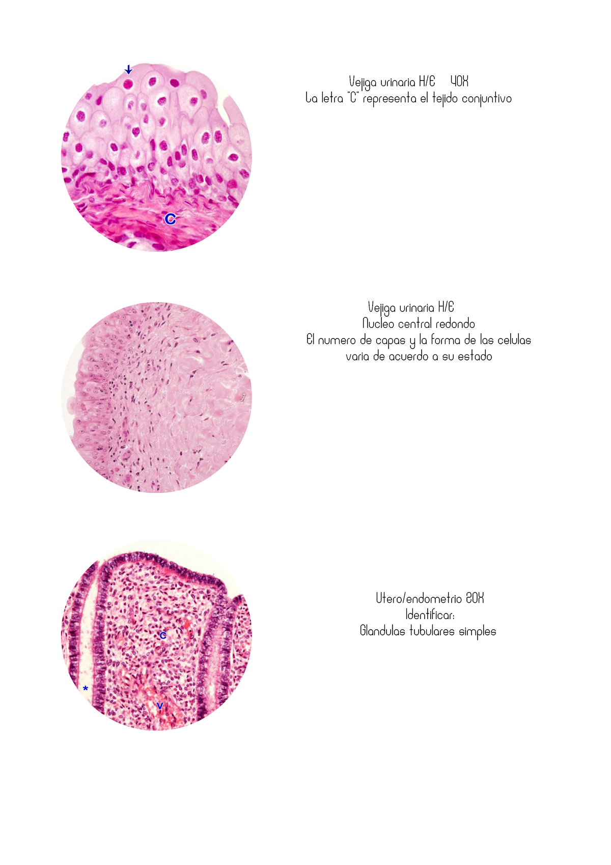 histología de la vejiga