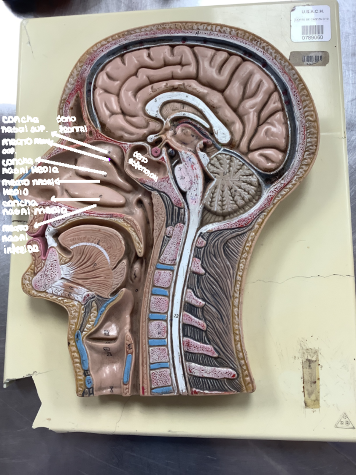 Sistema Respiratorio - anato - concha seno nasal sup., drontal meCTO ...