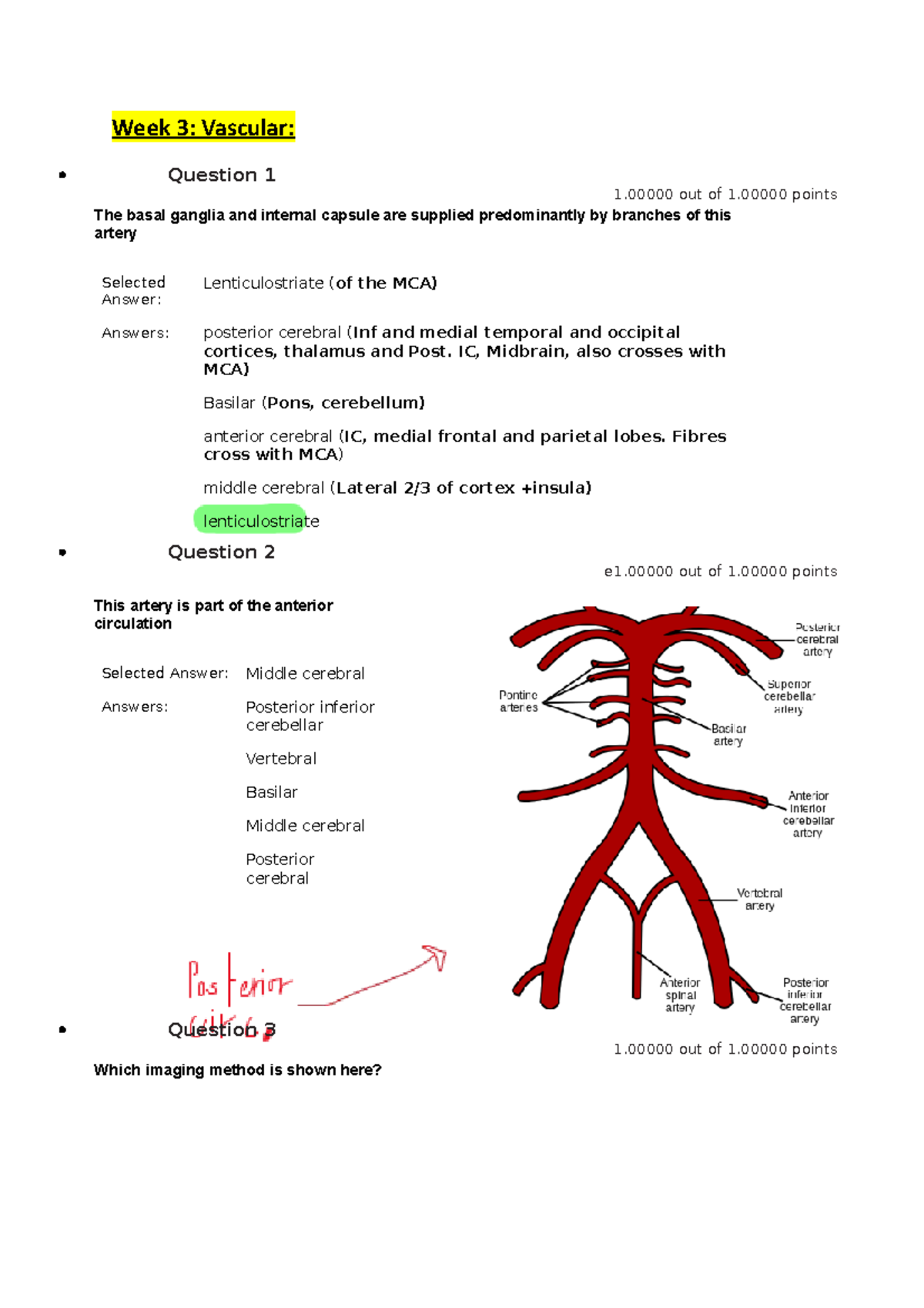 All LQ Lecture notes 13 Week 3 Vascular Question 1 1 out of 1