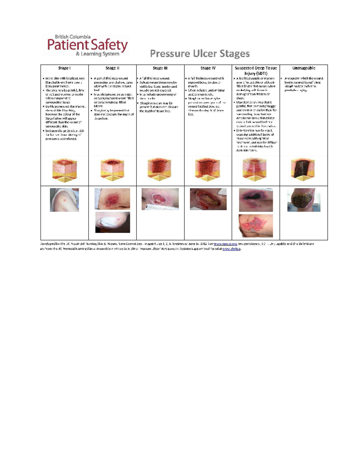 Diagnosis decubitus pressure staging ulcers original - NURSE 154 - Studocu