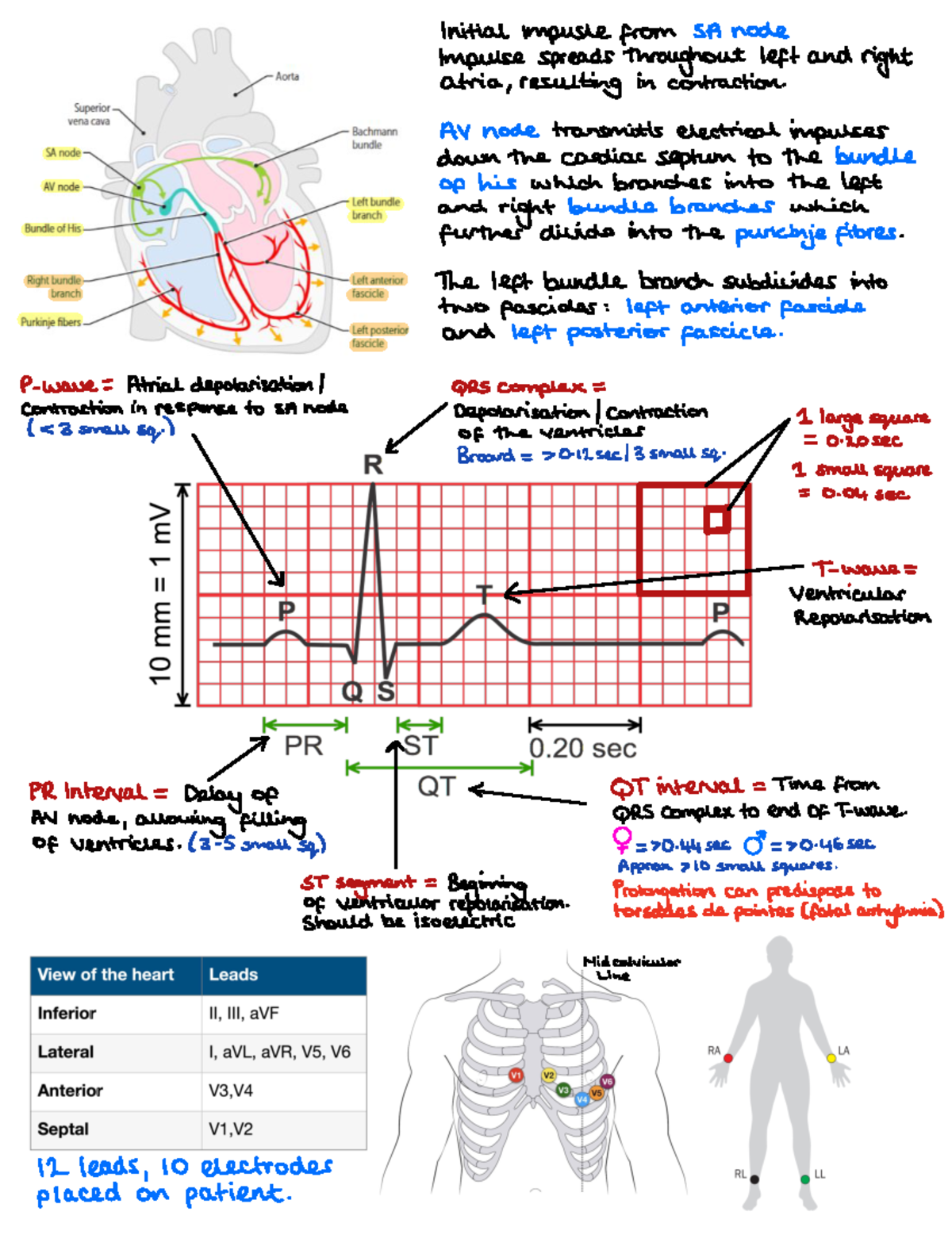 ECG Interpretation - ... - Initial impusle from SA node Impulse spreads ...