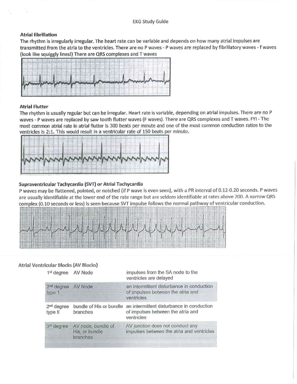 EKG Study Guide 2021 - EKG STRIPS - NUR 312 - Studocu