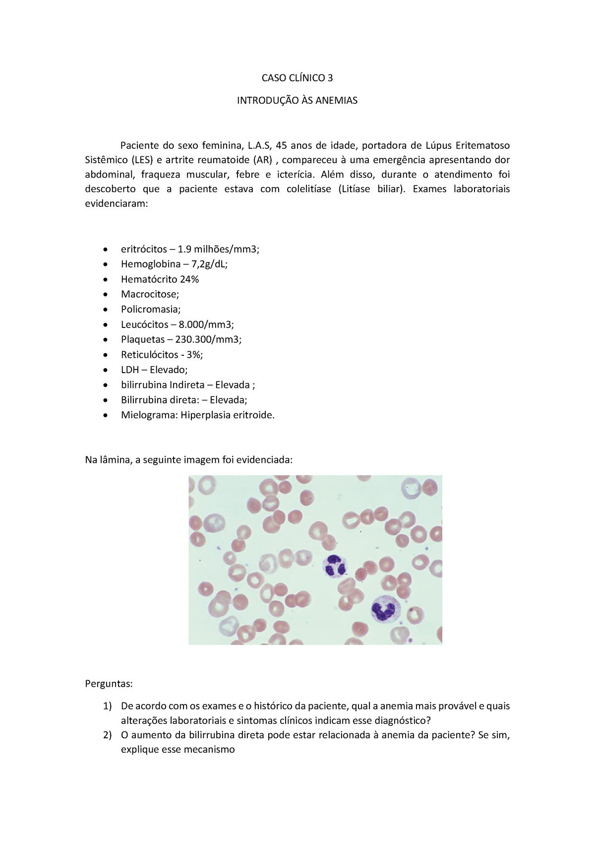 Caso Clínico 3 Hematologia Clínica Caso Fictício Caso ClÍnico 3 IntroduÇÃo Às Anemias 