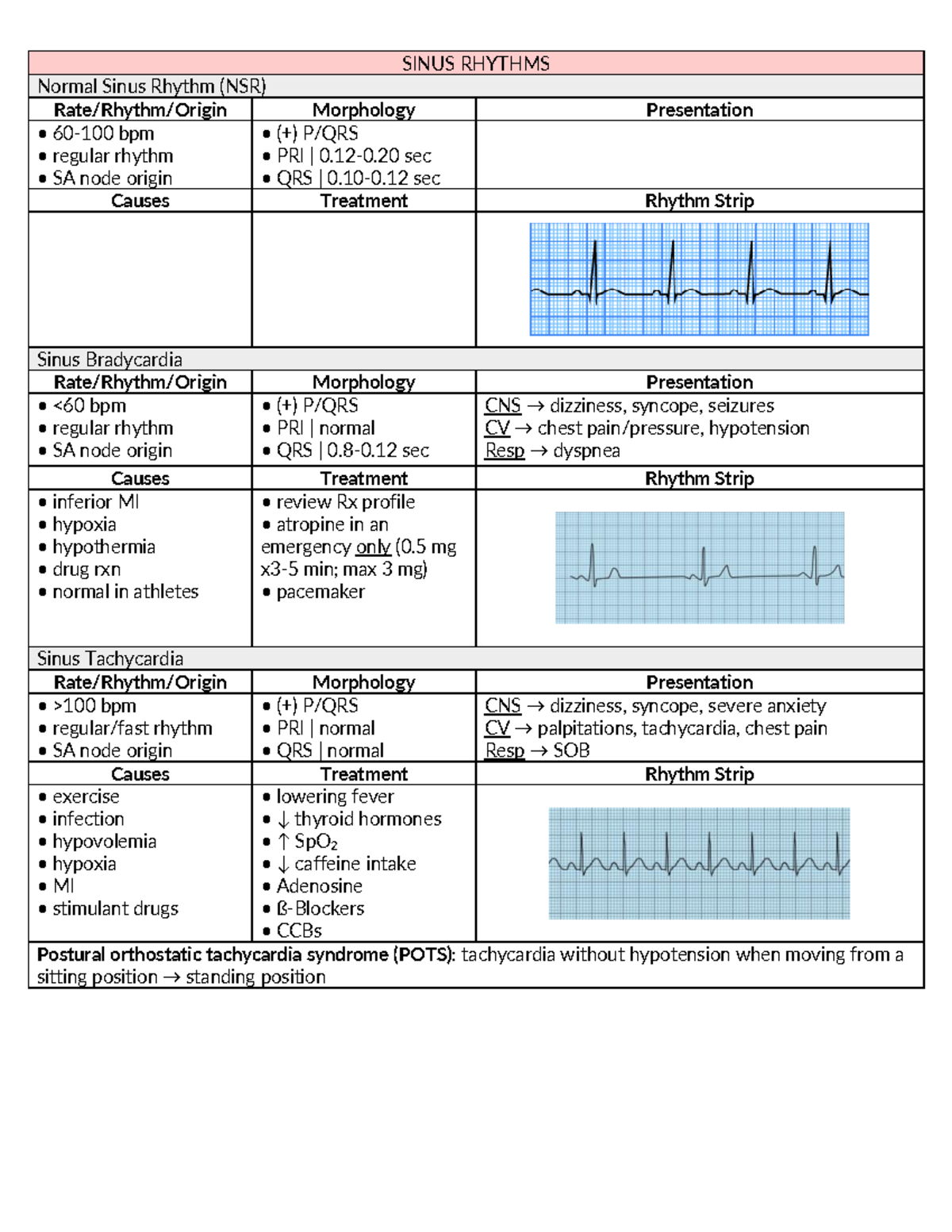 Dysrhythmia Quick Chart - SINUS RHYTHMS Normal Sinus Rhythm (NSR) Rate ...