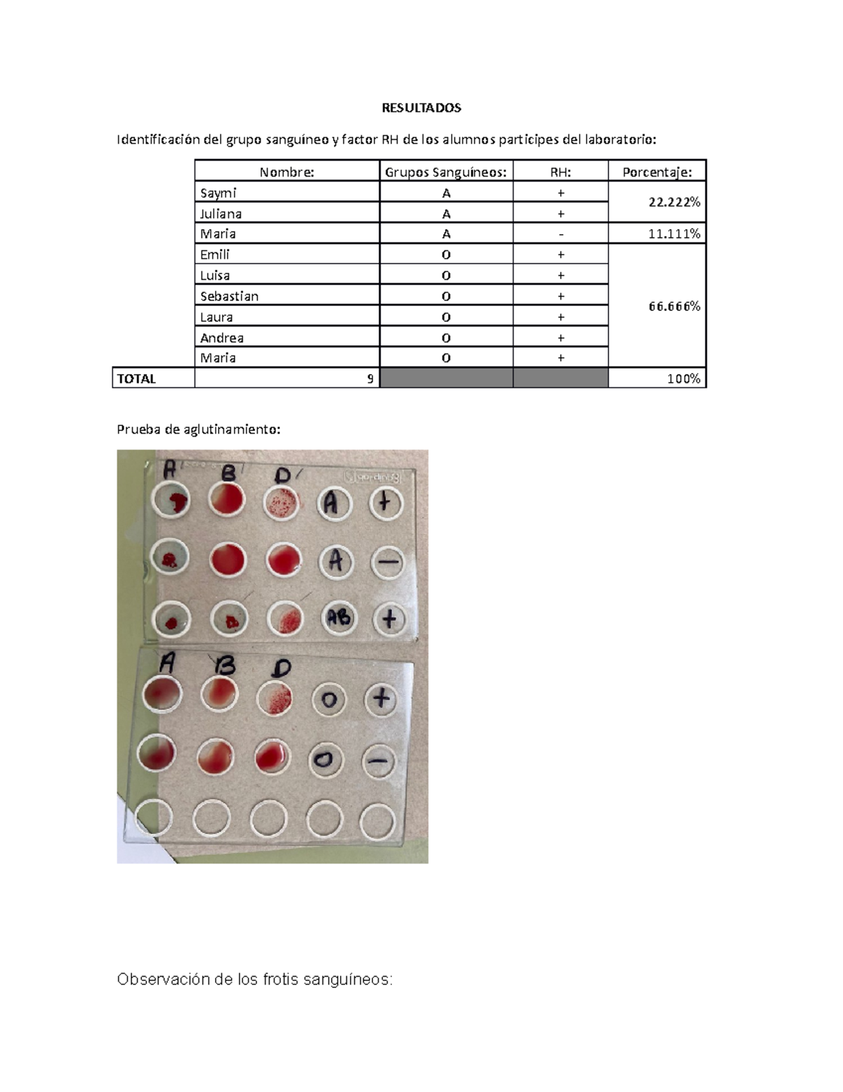 Informe De Laboratorio Frotis De Sangre Y Rh Resultados