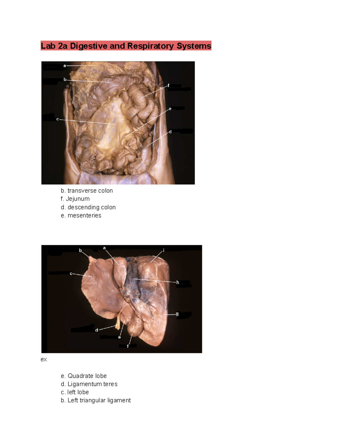 LAB Exam 2 - Lab 2a Digestive and Respiratory Systems b. transverse ...